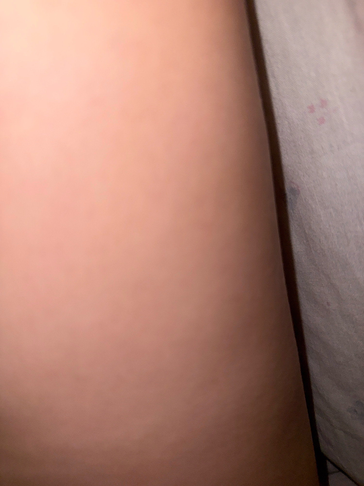 The image shows a close-up view of a person's skin next to a grey, textured fabric, possibly bedding. The skin is smooth and appears to be from an arm or leg. The fabric has a subtle pattern and some faint pink or reddish marks scattered across it. The lighting is dim, casting a soft glow on the skin and creating shadows. There are no discernible features of the city of Zavolzhye, Russia in this image.