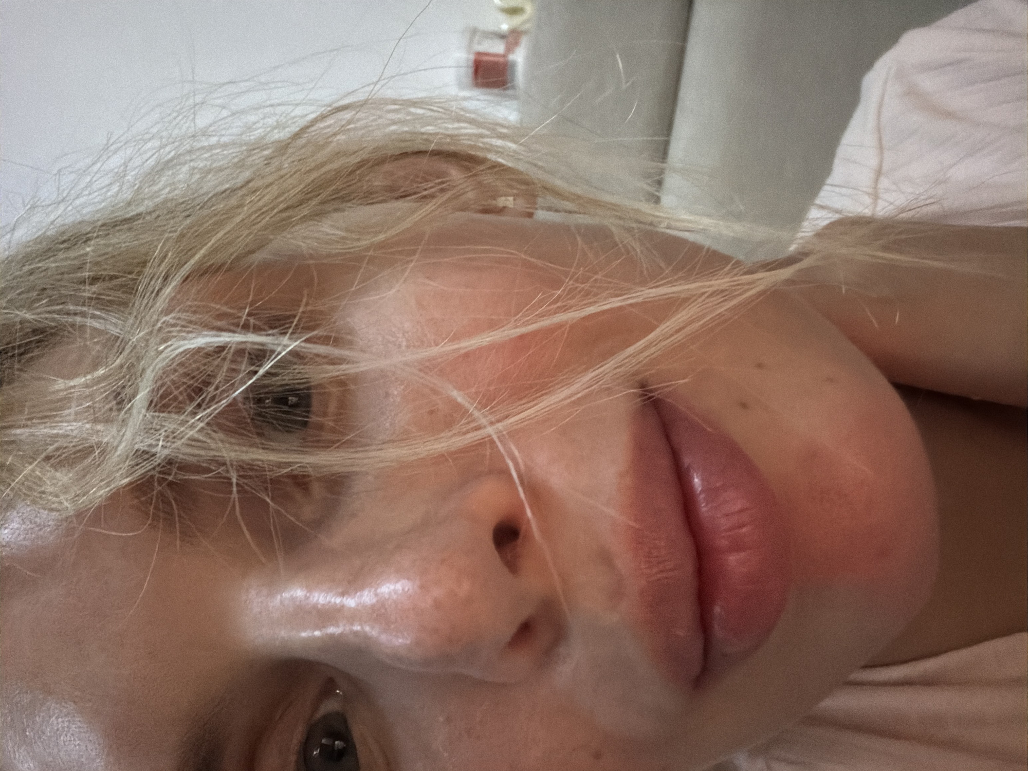 A close-up, slightly angled, portrait of a fair-skinned woman with blonde hair partially covering her face. Her eyes are visible and appear dark. Her nose is prominent and slightly shiny. Her lips are full and have a pinkish hue. The woman's skin appears to have a slightly flushed complexion, particularly on her cheek. Her hair is somewhat disheveled, with strands falling across her face.
The background is blurred, but there appears to be a white wall or surface and a soft, off-white or beige cushion or pillow. The location in the city of Budva, Montenegro cannot be determined from the image.