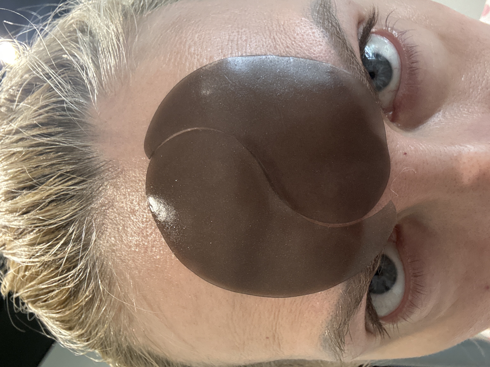 A close-up, tilted view of a person's face. The person has blonde hair and blue eyes. Under-eye patches are placed beneath the eyes, dark brown in color and crescent shaped. The person's skin appears fair. The location is unknown.