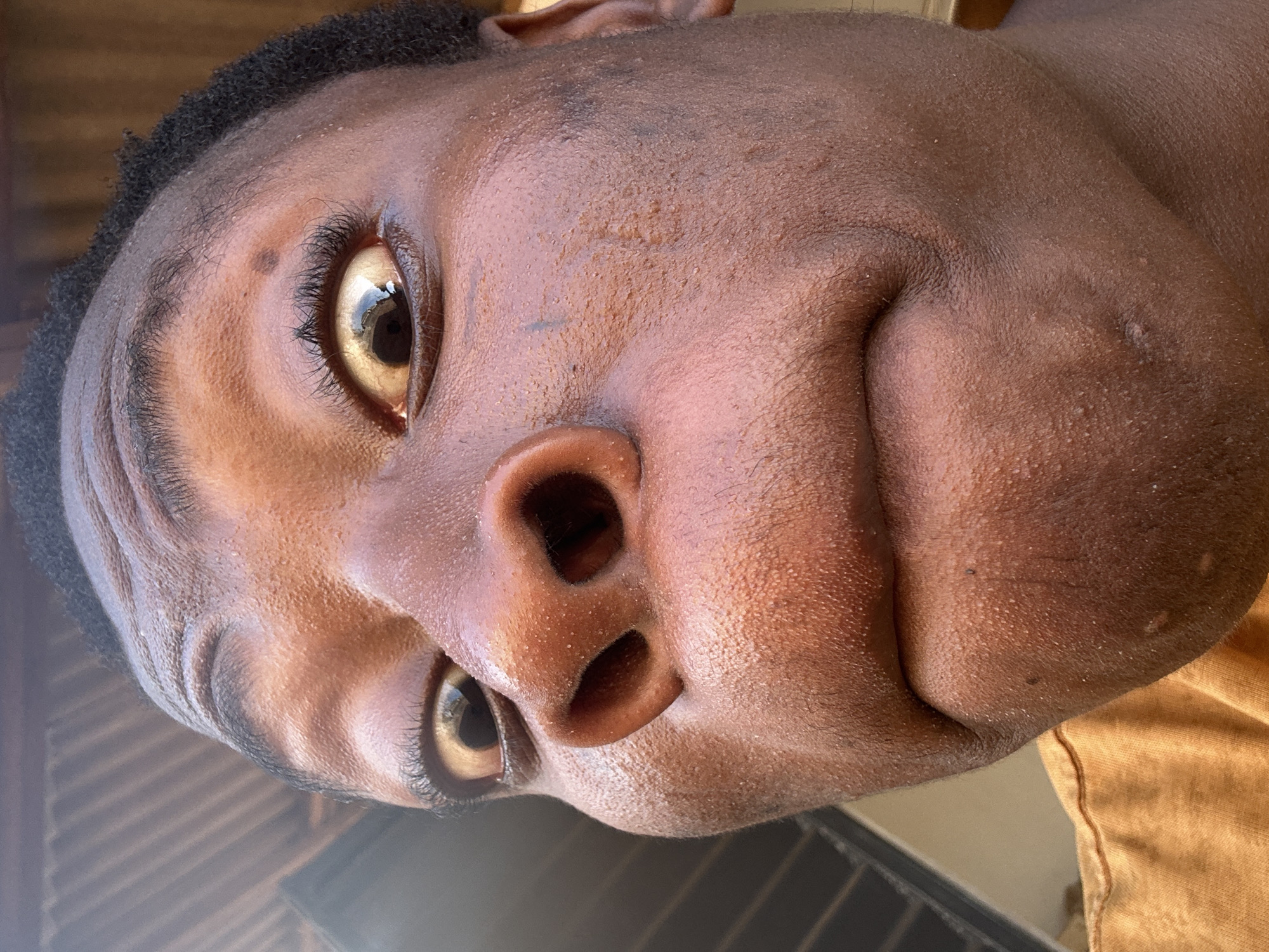 A close-up, low-angle portrait features a person with dark skin and short, dark, curly hair. The individual is looking directly up towards the camera, which creates a distorted, almost fish-eye effect, making the chin and lower face appear significantly larger and closer. The person's cheeks are full or slightly puffed out.
Notable details include striking light brown or amber-colored eyes with prominent long eyelashes and visible reflections. The skin has a textured appearance with visible pores and small bumps, and a small, dark mole is present above the individual's right eye (viewer's left). The nostrils are clearly visible due to the upward angle. A small portion of a mustard yellow or light brown garment is visible in the bottom right corner of the frame. The background is softly blurred, showing muted warm tones and some faint horizontal lines, possibly from a wooden or slatted surface. The lighting is bright, suggesting natural light. No text is visible in the image.