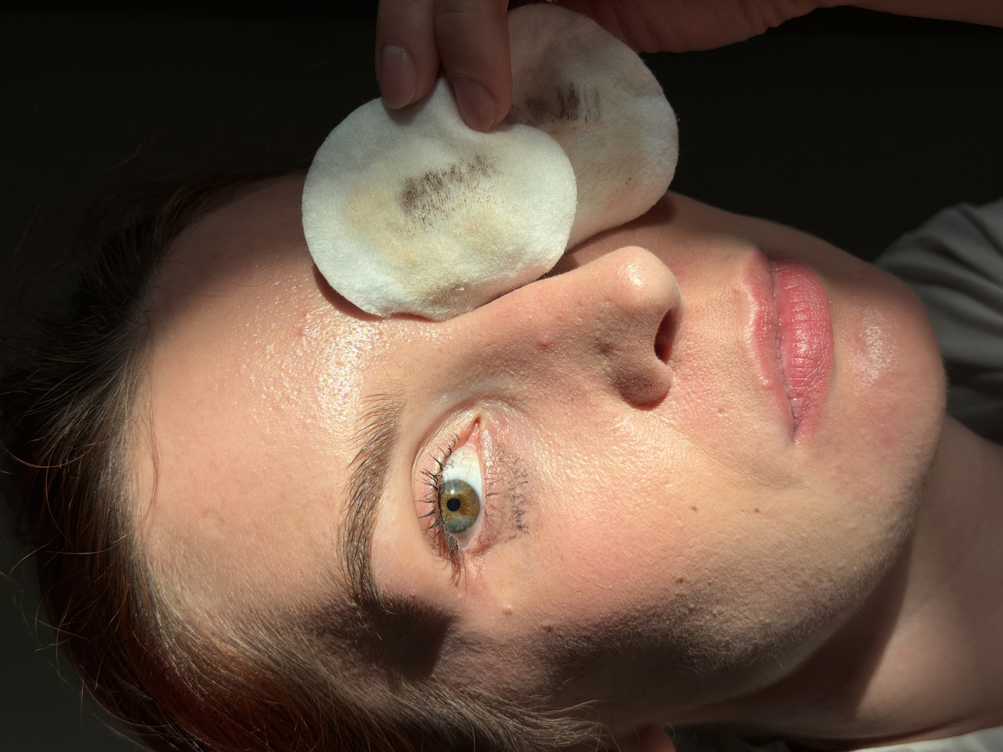 A close-up, angled view shows a person's face with two cotton pads covering their forehead and eyes. The pads show residue of makeup. The person has light skin, with visible pores and fine hairs. Their lips are pink. Their visible eye has light eyelashes and eyebrow hairs. The background is dark and out of focus. There is no information available in the image or description about location or city.