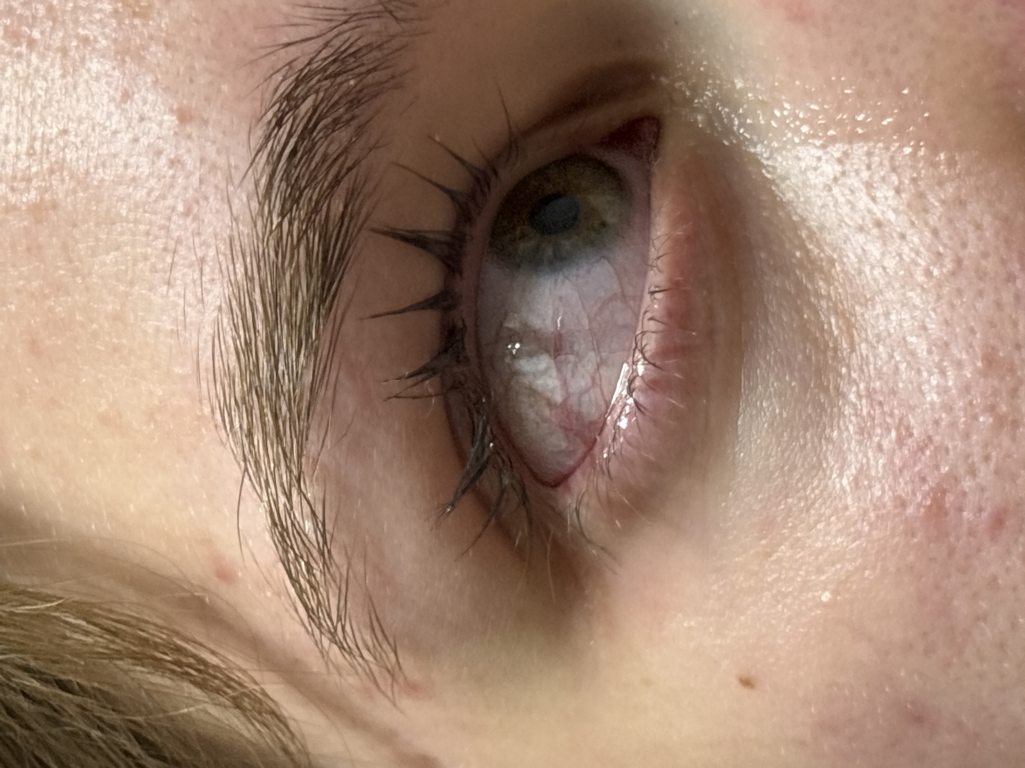 The image shows a close-up of a human eye. The eye is open and appears bloodshot, with prominent blood vessels visible in the sclera. The iris appears to be hazel or green, and the pupil is visible. Eyelashes are present, some appearing clumped or coated with mascara. The skin around the eye shows pores and some minor skin imperfections. The subject's brow is visible, and the eyebrow is light brown with individual hairs clearly defined. The image contains no information about Perm, Russia.