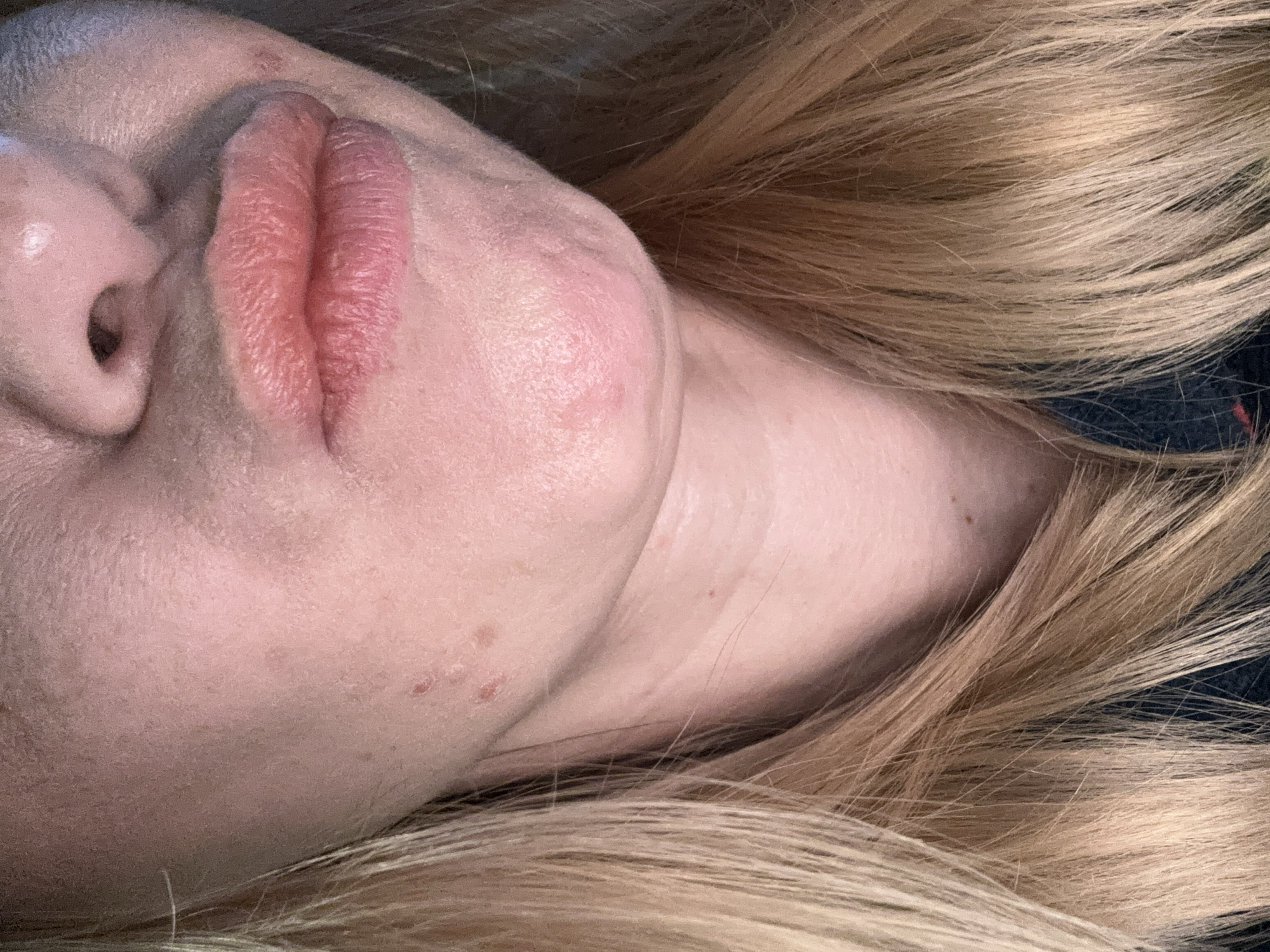 The image shows a close-up of a person's face, angled slightly, with the nose and lips prominently displayed. The person has blonde hair, some of which is framing the face. The skin appears somewhat dry. There is no information available to determine the location in any city, or any other information about the environment.
