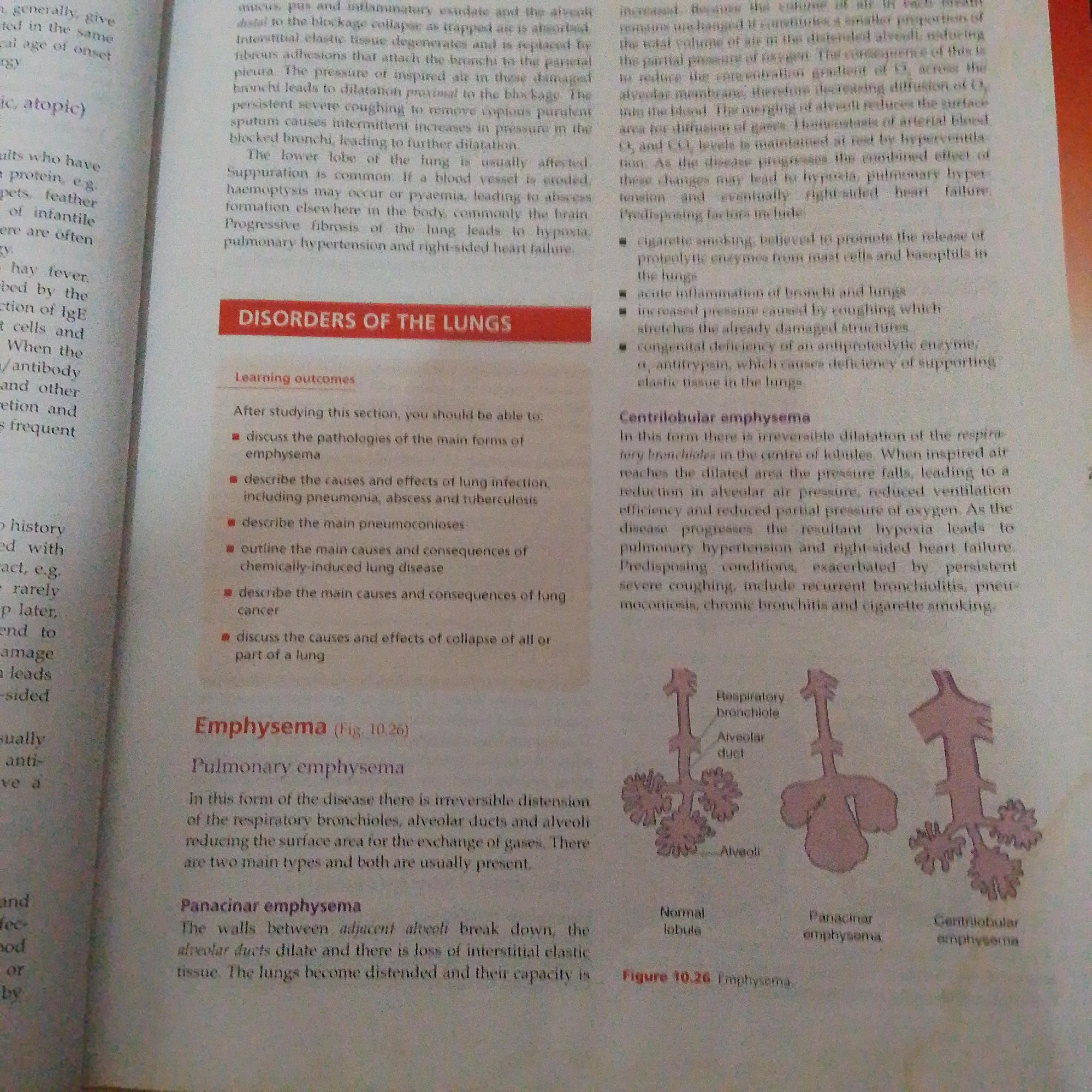 This is a close-up, overhead photograph of an open textbook, focusing on a page detailing medical information about "Disorders of the Lungs," specifically "Emphysema." The text is printed in black ink on white paper.
The page is divided into several sections. At the top, there is a heading "DISORDERS OF THE LUNGS" in a red bar, followed by "Learning outcomes" which lists several bullet points detailing what a student should be able to do after studying the section. Below this, the primary topic "Emphysema" is introduced with a figure reference "(Fig. 10.26)". The text then elaborates on "Pulmonary emphysema" and its two main types: "Panacinar emphysema" and "Centrilobular emphysema."
To the right of the text, a diagram labeled "Figure 10.26 Emphysema" illustrates the structures of a normal lobule, panacinar emphysema, and centrilobular emphysema. These diagrams show simplified representations of bronchioles, alveolar ducts, and alveoli, highlighting the changes that occur in emphysema.
On the left side of the page, there are also several paragraphs of text that appear to be continuations or related information from previous sections, discussing conditions like bronchitis and atopic reactions, and mentioning symptoms like hay fever and IgE.
The lighting suggests indoor illumination, typical of reading in a well-lit room. There are no people visible in the image. The focus is entirely on the printed content of the textbook. The overall impression is one of educational material being presented.