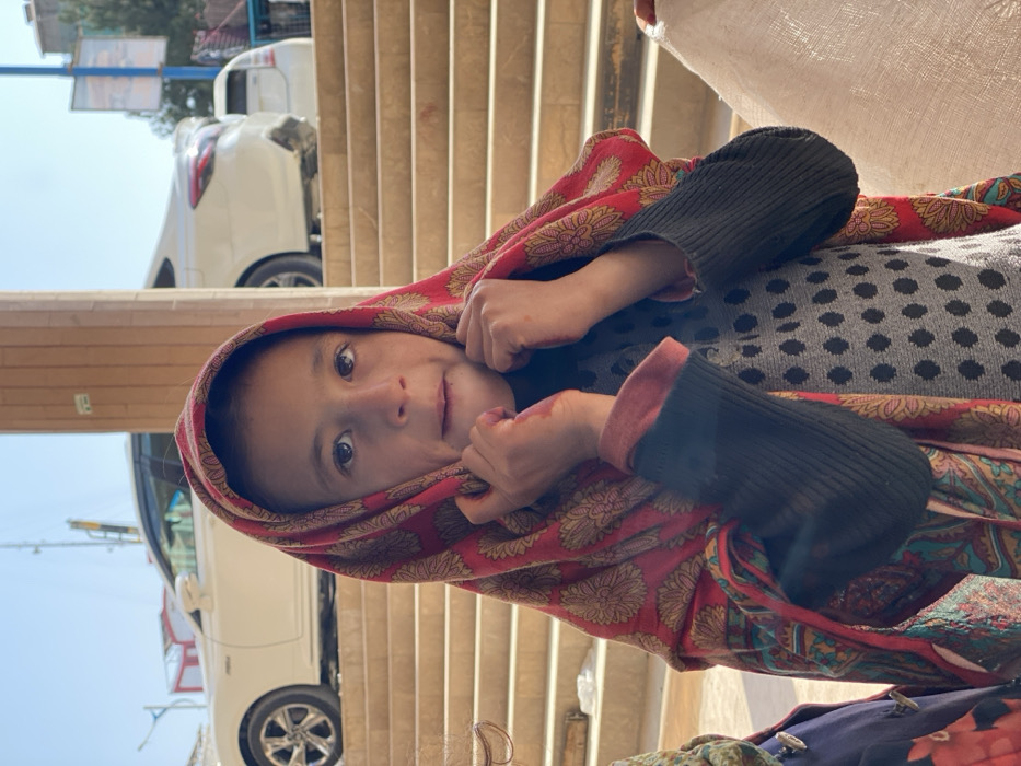 A young girl, approximately 6-10 years old, is depicted in a medium close-up, facing forward, against an outdoor urban background in Kandahar, Afghanistan. She has dark hair and eyes, and a fair complexion. Her expression is neutral to slightly inquisitive, with her mouth slightly ajar. She is wearing a red patterned headscarf with gold/yellow floral motifs, which she holds up with both hands at chin level. Her hands show a reddish stain, possibly from henna or dirt. She wears a grey long-sleeved top with black polka dots, layered over a dark grey/black ribbed long-sleeved shirt with a salmon-pink cuff visible at her right wrist.
To her immediate left, part of another individual's shoulder and blue garment with a silver clasp are visible. To her right, a light-colored, textured fabric, possibly part of another person or object, is partially visible in the foreground.
In the mid-ground, behind the girl, a series of light-colored, wide stone or concrete steps ascend. A light brown, multi-ridged pillar is positioned on the right side of the frame, partially obscuring the steps.
In the far background, positioned above the steps, a white Lexus ES sedan is visible, parked or moving leftward. Behind it, partially obscured by the Lexus and a distant structure, is another white compact vehicle, possibly a Toyota Prius, facing right. A blue utility pole with an indistinct sign is visible to the far right. Distant structures and a clear blue sky are also present. The scene is brightly lit by natural sunlight, indicating an outdoor setting during daylight hours.