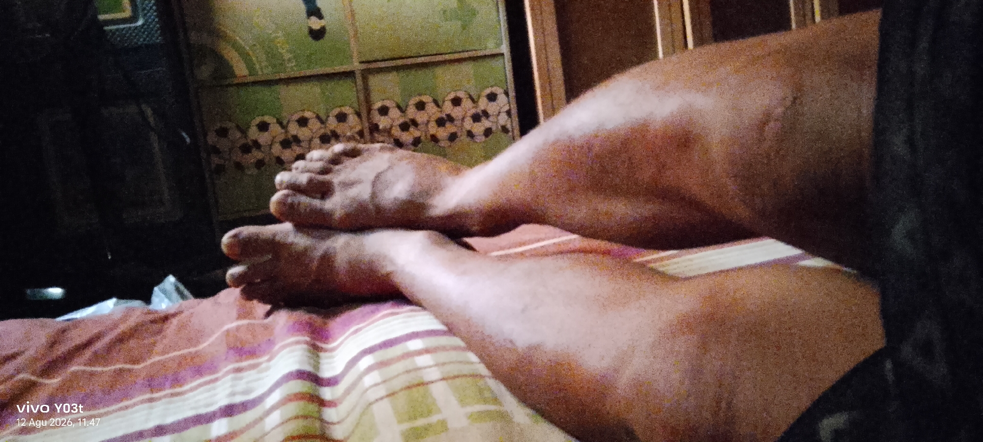 The image shows a close-up view of a person's legs and feet, which are resting on a bed with striped bedding. The background features a wall with a pattern of soccer balls and green segments, suggesting a bedroom or living space. A dark, blurry object is visible on the right side of the frame. The lighting is dim, creating shadows and highlighting the texture of the skin. The timestamp "vivo Y03t 12 Agu 2026, 11:47" is embedded in the lower left corner of the image, indicating the photograph was taken with a Vivo Y03t phone on August 12, 2026, at 11:47 AM. There is no information about the location in Woiha, Indonesia.