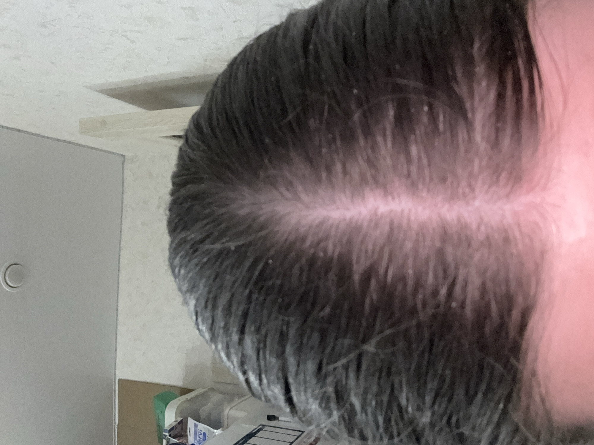 The image shows the top of a person's head, with dark hair parted down the middle. The scalp is visible in the center part, and appears to have a pinkish hue. Small white specks, possibly dandruff, are scattered throughout the visible hair and scalp. The background is blurred, but appears to be an indoor setting with a wall and some objects on shelves. There is no indication of the location being in Saratov, Russia, or any other specific geographical location.
