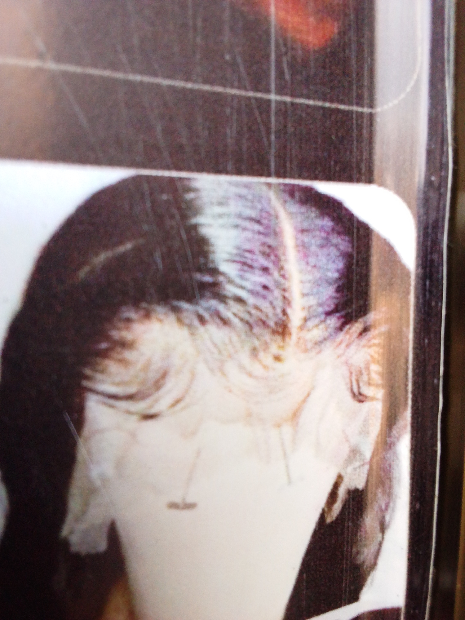 The image shows a close-up of a photograph or printed image of the back of a person's head and shoulders. The person has dark hair with a visible parting at the crown. The skin appears light in color, and parts of the neck and ear are visible. There is a small, dark horizontal mark near the nape of the neck. The image is cropped tightly, and it's difficult to discern further details. There is no information available to connect the image to the city of Aba, Nigeria.