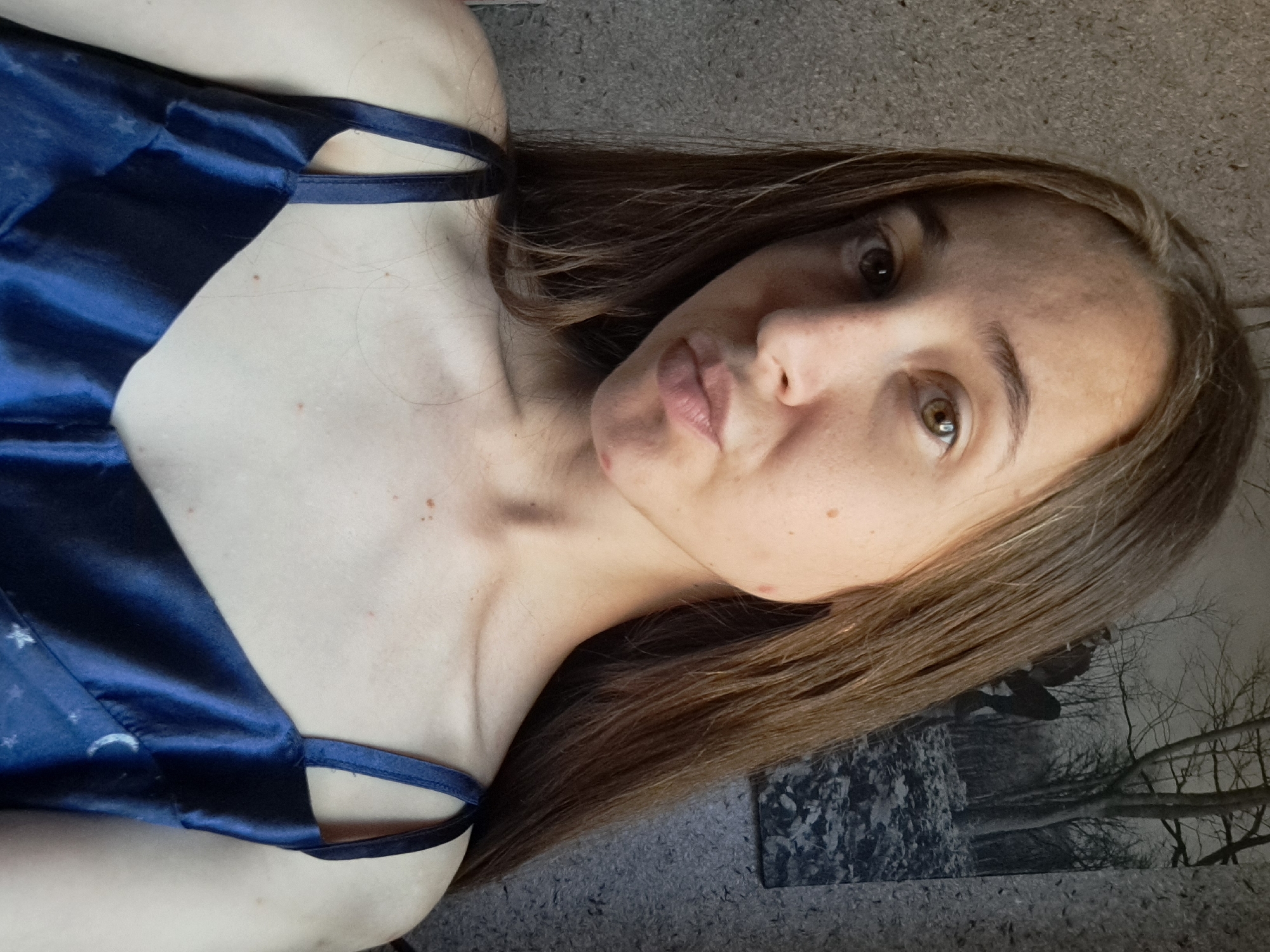 A young woman with long brown hair and fair skin is pictured in a selfie. She is wearing a dark blue, spaghetti-strap top with a celestial pattern of stars and moons. Her skin has several small moles and a blemish on her chin. The background appears to be an indoor setting with a corkboard-like wall on the left and a framed black and white photograph of a forest scene on the right. The lighting suggests it is daytime, possibly from a window.