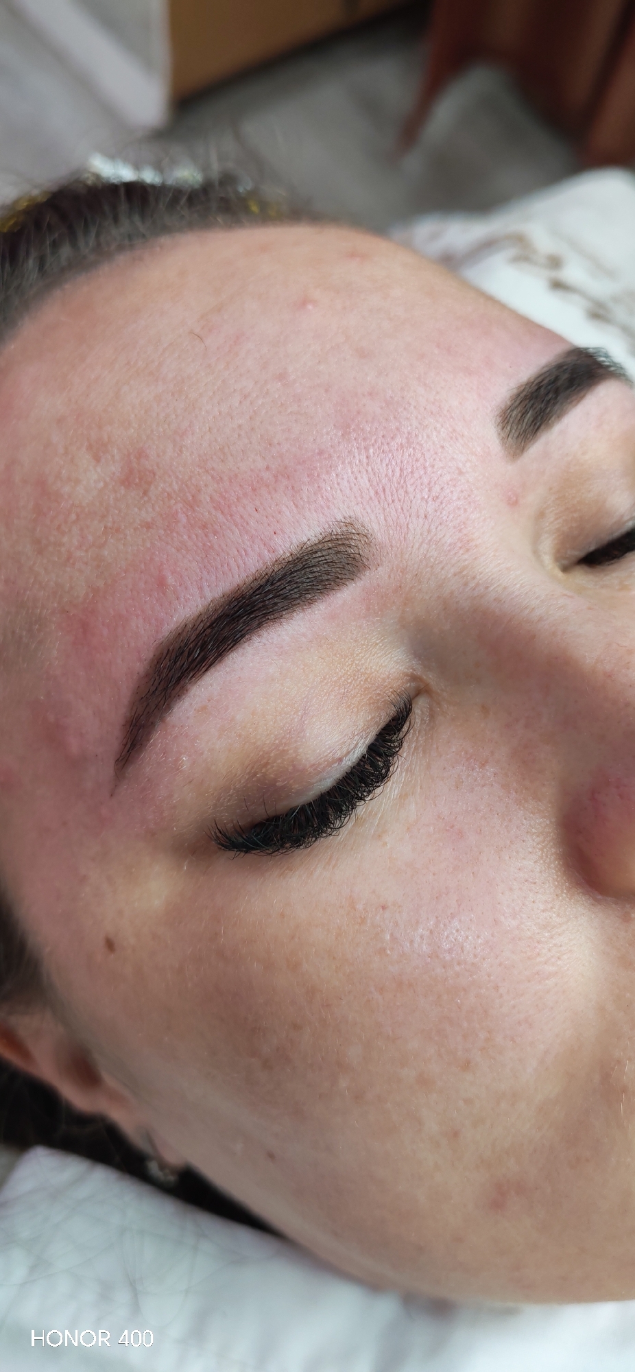 A close-up shot shows a person's face, likely a woman, with her eyes closed. Her eyebrows are well-defined and appear to be recently done or filled in. Eyelash extensions are visible on her upper eyelids. The skin on her forehead and face exhibits some redness and minor blemishes. The environment appears to be a salon or spa setting. There is no information about the location in the city of Noviy, Russia.