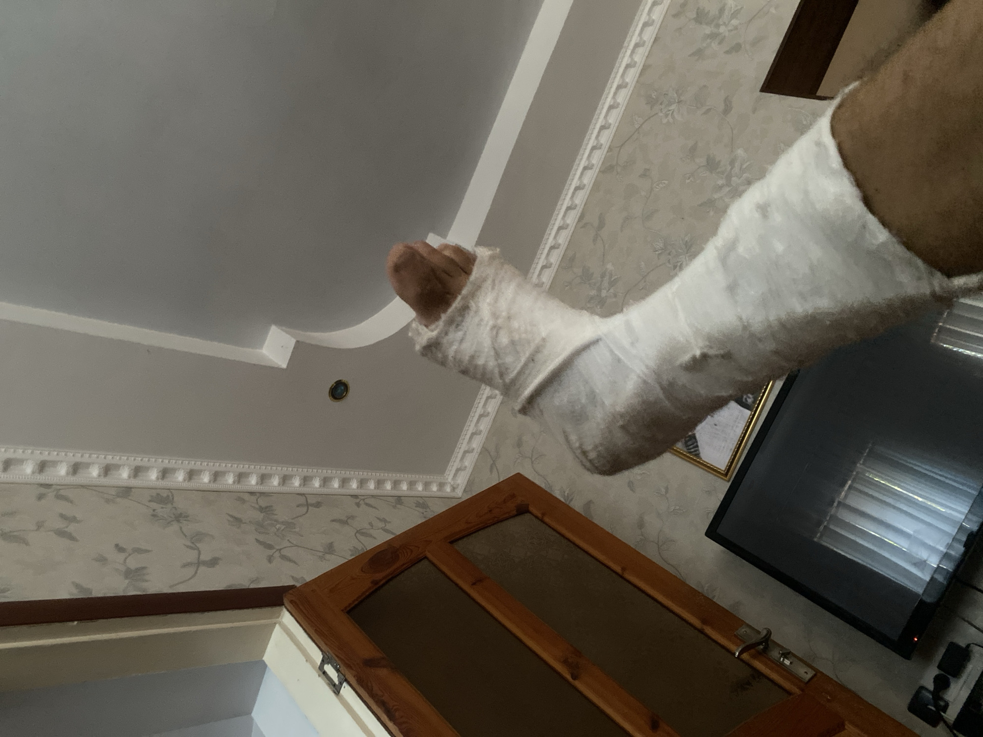 An indoor scene features a person's lower leg and foot, encased in a white cast, extending from mid-shin down to the toes. The cast appears to be made of plaster or fiberglass. The foot is pointed slightly upwards. In the background, a wall with a floral wallpaper pattern is visible, topped by decorative white molding. A wooden cabinet with glass panels is to the left, and a television set is below it. The ceiling is also visible, painted in a neutral color with some architectural detailing. The image is taken from a low-angle perspective, looking upwards at the casted leg. The location is identified as a village in the Oytal rural district of Kazakhstan.