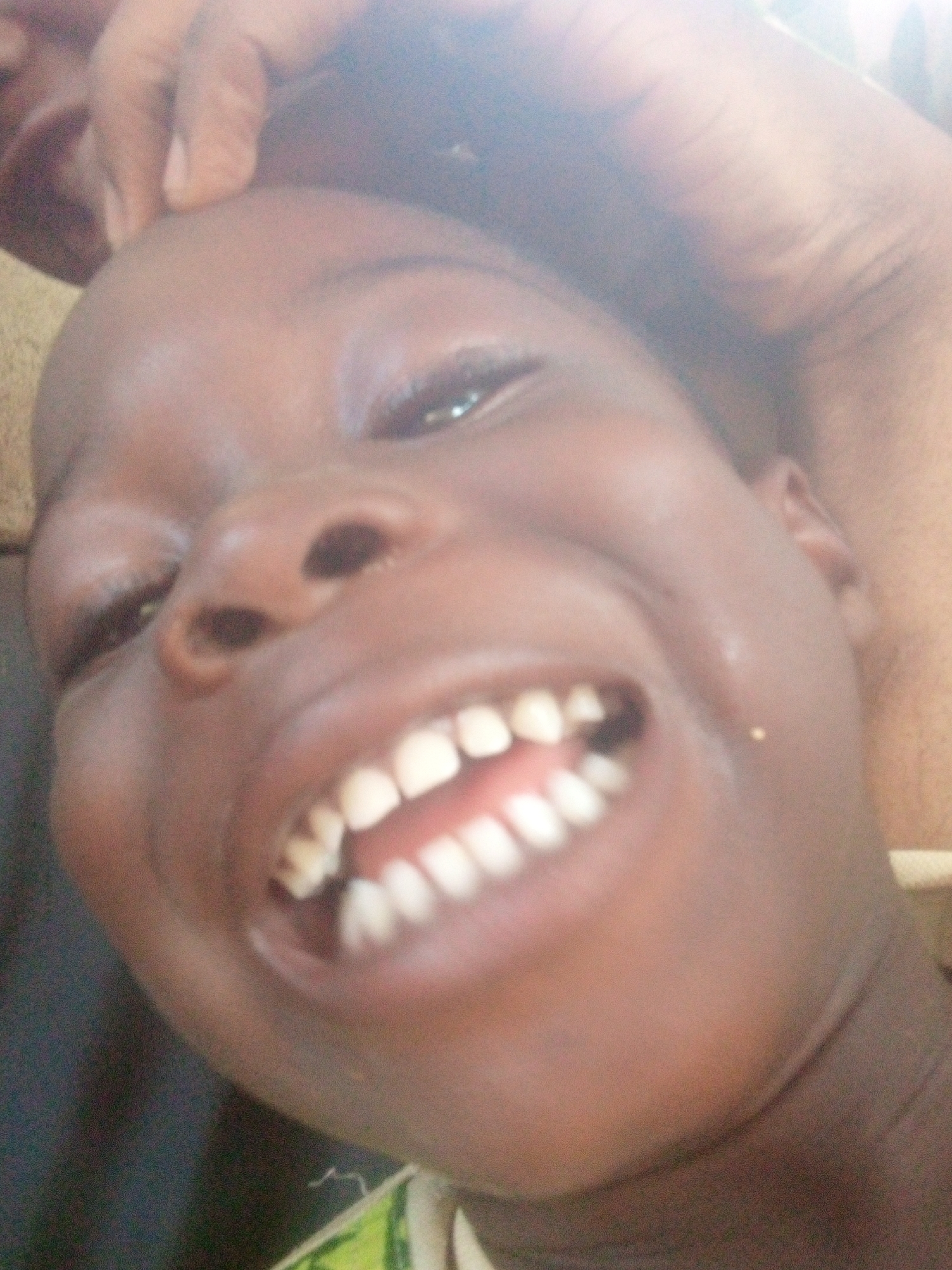 A close-up, slightly distorted view depicts a smiling child. The child has dark skin, and their mouth is open wide, revealing a full set of white teeth. An adult hand is positioned near the child's forehead, with the fingers partially visible. The background includes a blurry area suggesting a person's shoulder and clothing. The location is unknown.