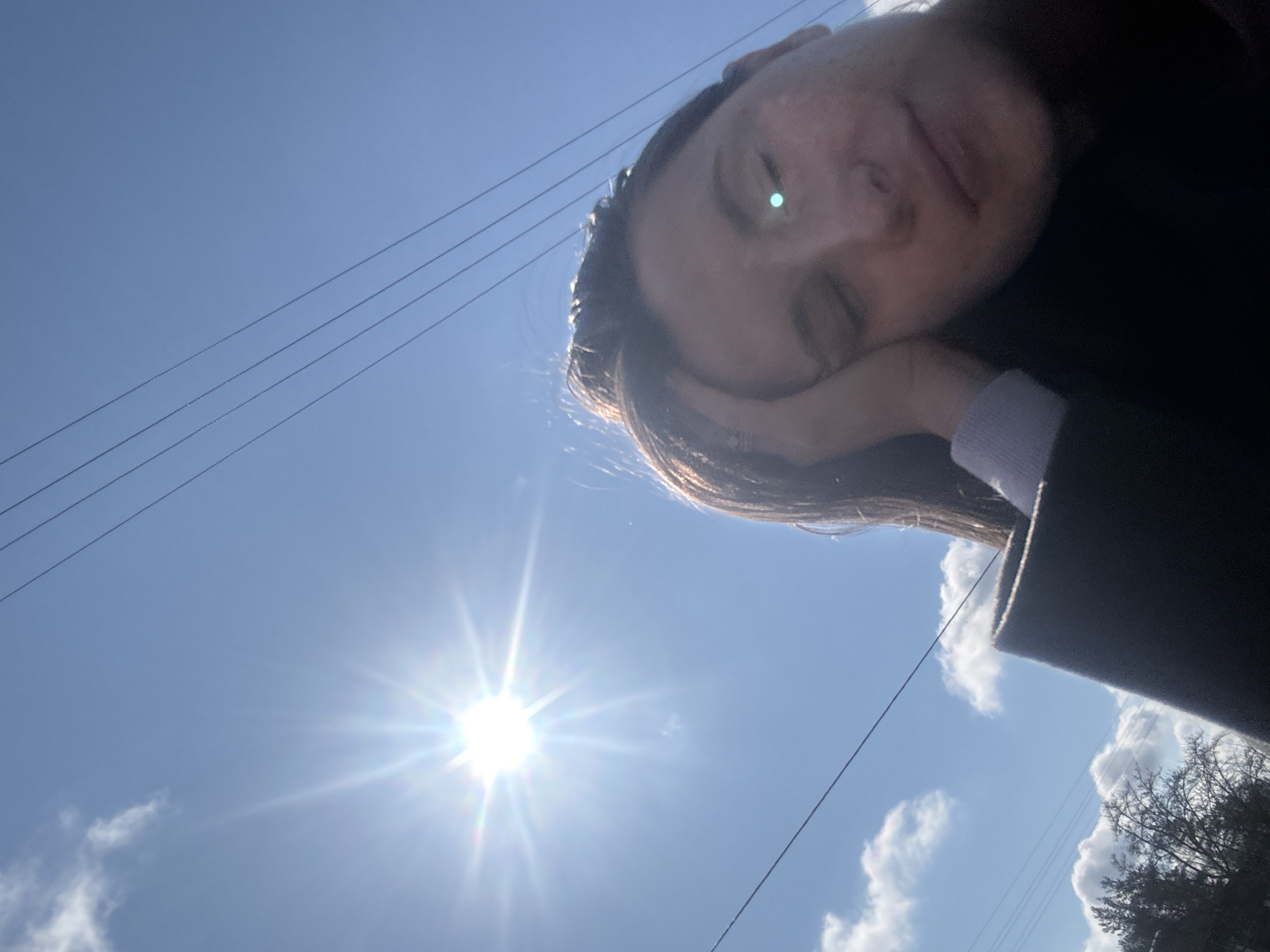 A selfie-style photograph features a person's face, partially obscured by their hand, under a bright, sunny sky. The person's eyes are mostly closed, and their face is illuminated by the sun, creating a lens flare effect. In the background, the sky is blue with a few scattered clouds and the sun is visible, emitting a strong glare. Power lines stretch across the upper left portion of the frame. Trees are seen in the bottom right corner. The location is Unknown, Unknown.