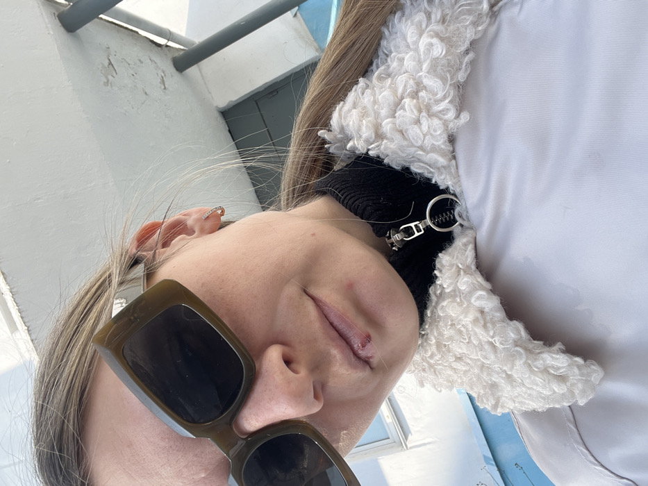 The image displays a close-up, angled view of a female individual situated outdoors in Chaikovsky, Russia. The subject wears dark, rectangular, olive-green sunglasses and has light brown hair pulled back, with a silver hoop earring visible on her right ear. A minor injury, consistent with a laceration or abrasion, is present on the lower lip, slightly left of center, showing dried blood. A faint reddish mark is also visible on the skin above the right corner of her mouth. She is dressed in a black high-collared garment, partially obscured by a light-colored jacket featuring a prominent, off-white, curly faux-fur collar and a metallic zipper with a circular ring pull. The background consists of a brightly lit building facade with an off-white wall, a light blue painted section, a white window frame, and two dark grey vertical pipes or support columns next to a partially visible dark rectangular opening.