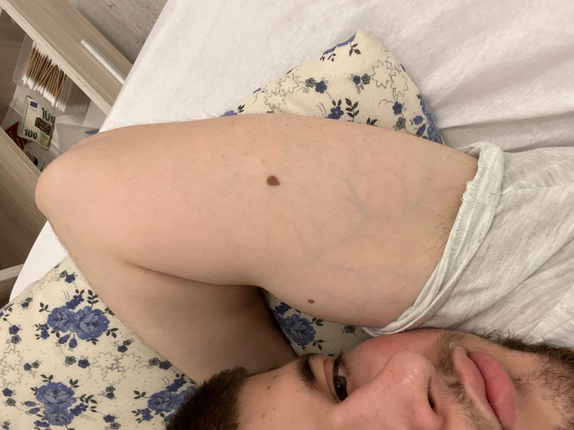 A close-up, first-person perspective shot features a person lying in bed. The person's right eye, nose, lips, and part of a beard are visible. The individual is positioned on a pillow with a floral pattern and beneath a white sheet or blanket. The person's arm is positioned over the pillow, revealing two moles on the upper arm. A partially visible drawer is present, containing cotton swabs and a 100 Euro bill. The location in Varna, Bulgaria cannot be determined from the visual information.