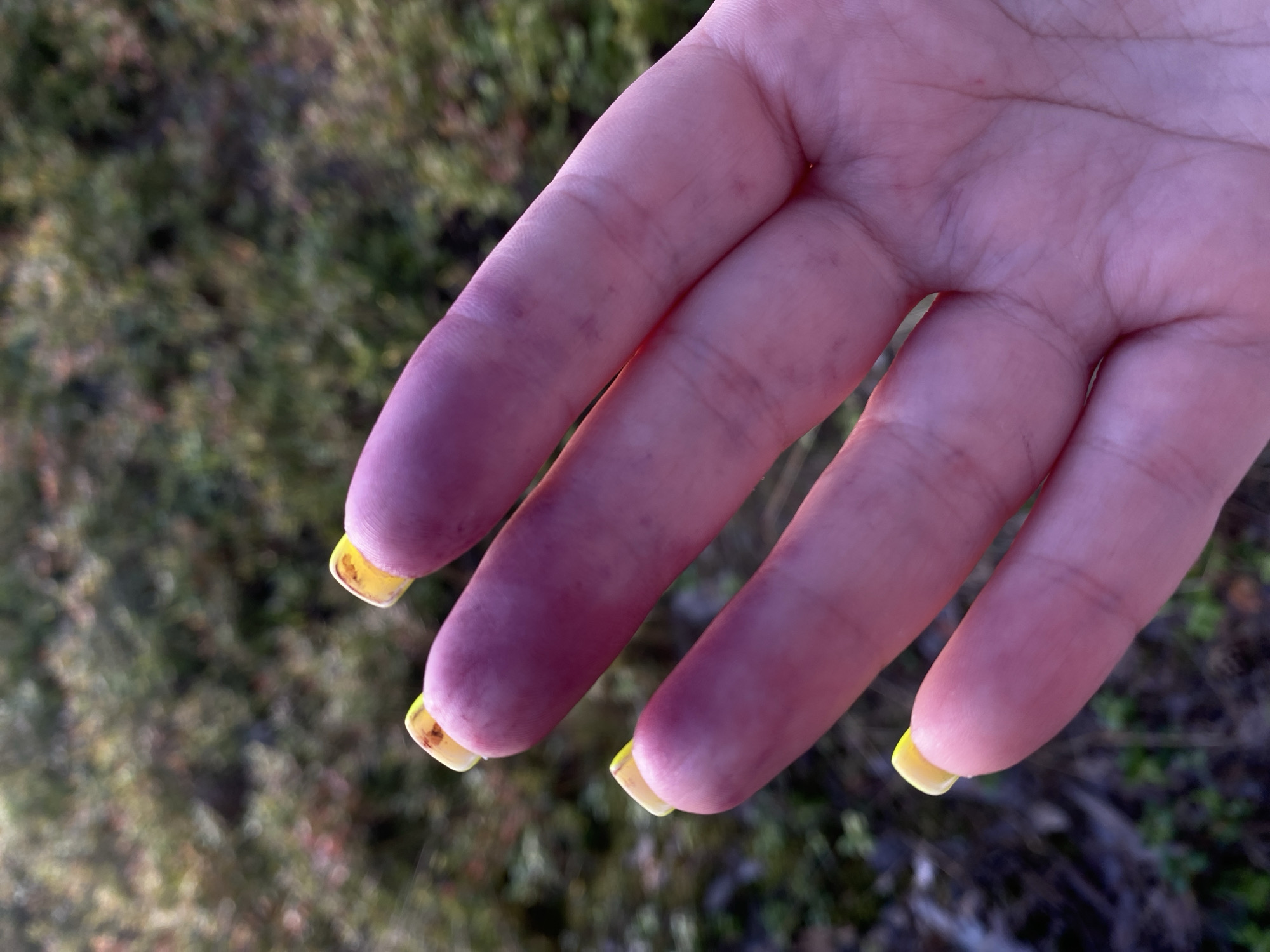 A close-up, outdoor shot focuses on a hand with fingers displaying a noticeable purple discoloration. The fingertips are particularly affected, with the purple hue fading towards the hand. The nails are painted a bright yellow color with some chipping. The background is blurred, consisting of green and brown vegetation, suggesting a natural outdoor setting possibly in Baltiiskoe, Russia. The lighting indicates it is likely daytime, with the sun casting a soft glow.