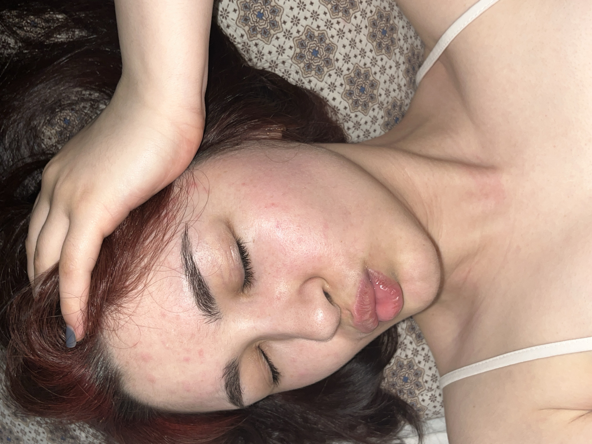 A woman with auburn hair is lying on a patterned surface. Her eyes are closed, and her hand rests on her forehead. She has fair skin with some redness on her face and chest. She is wearing a thin-strapped white top. The background is a beige fabric with a pattern of blue and brown floral designs. There is no information available to determine the location of the image in Neftekamsk, Russia.