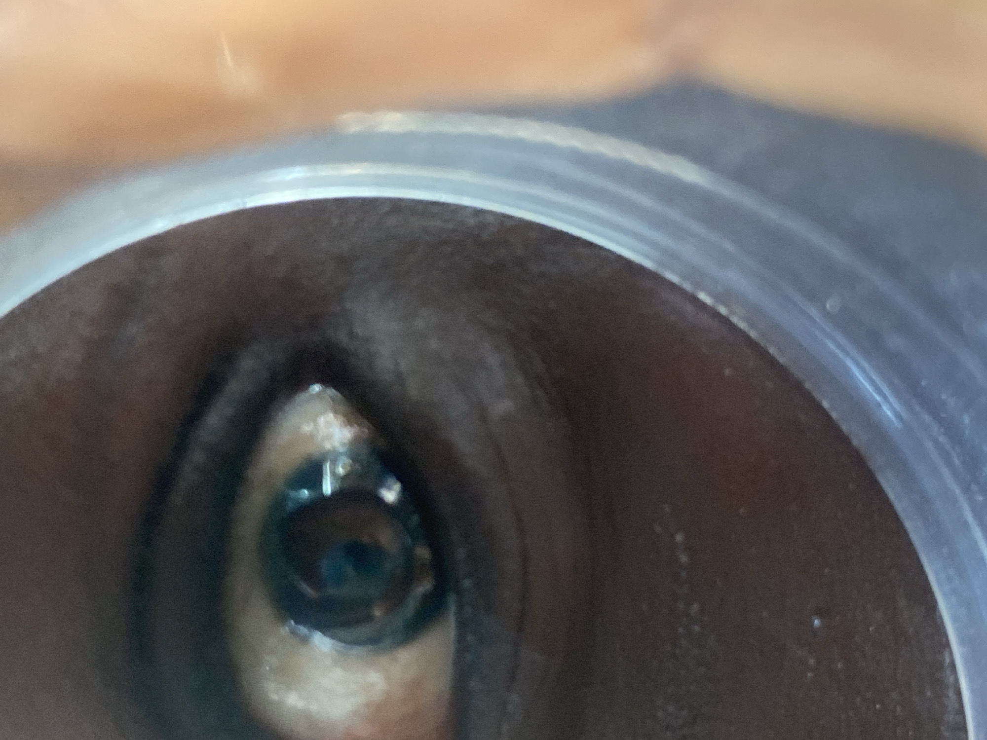 The image is a close-up, low-angle shot of a person's eye. The iris is dark brown, and a contact lens is visible. The surrounding skin is dark brown. A translucent, curved object, possibly a plastic container or lens, is in the foreground, obscuring part of the eye and cheek. The background is out of focus, showing a blurred area of skin tone. There is no discernible information about the location in Barden Yana, Nigeria, or any specific context for the image.