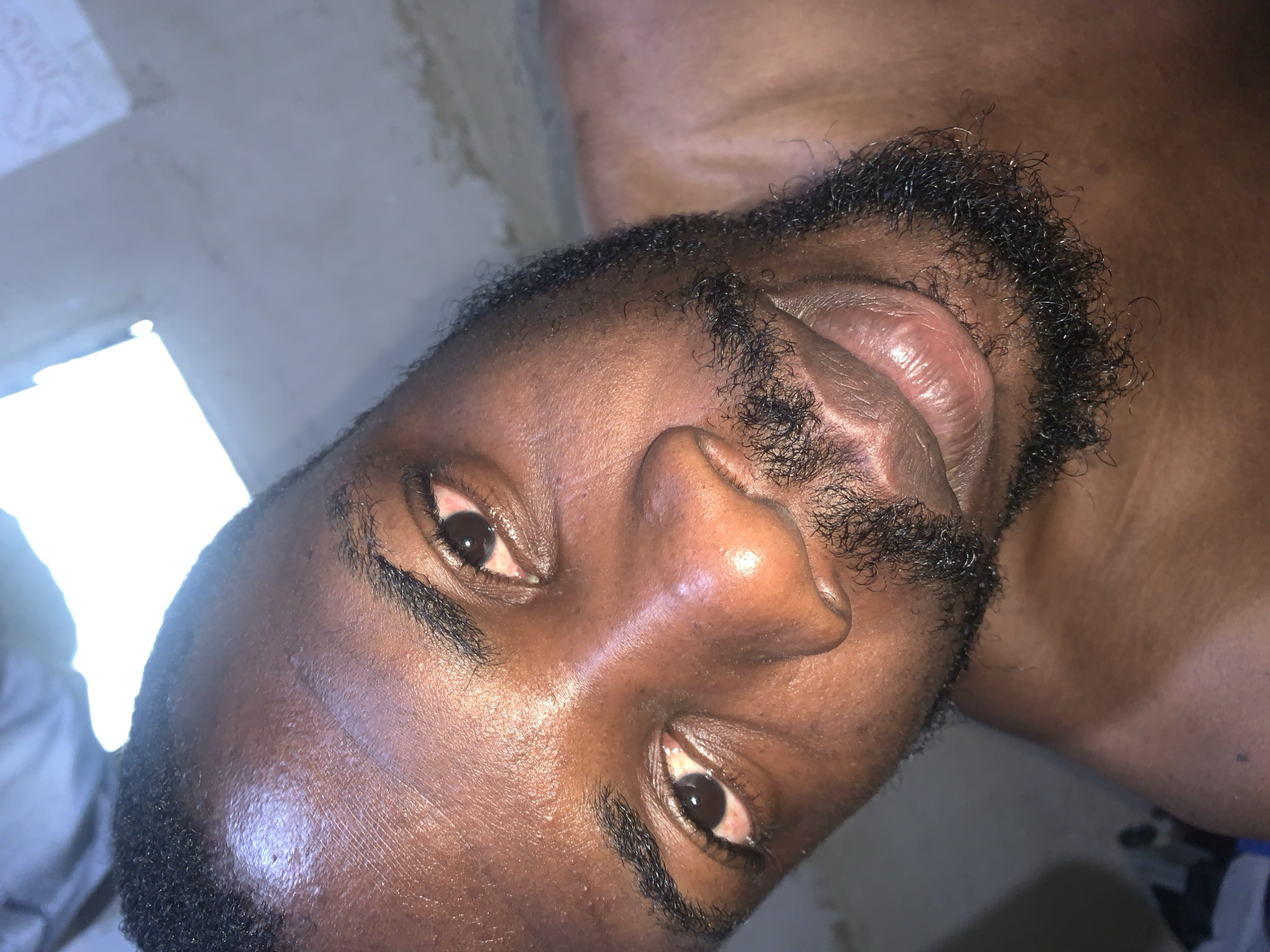 A close-up, overhead shot captures a Black man's face, from his forehead to his chin, in what appears to be an indoor setting. The man has short, dark, curly hair and a sparse, patchy beard. His eyes are open, with a slight redness visible in the whites, and he appears to be looking directly at the camera. His skin is dark and appears slightly oily. The background is blurred, with patches of light and shadow suggesting a window or light source. There are no visible details that definitively place this image in Rafin Par, Nigeria.