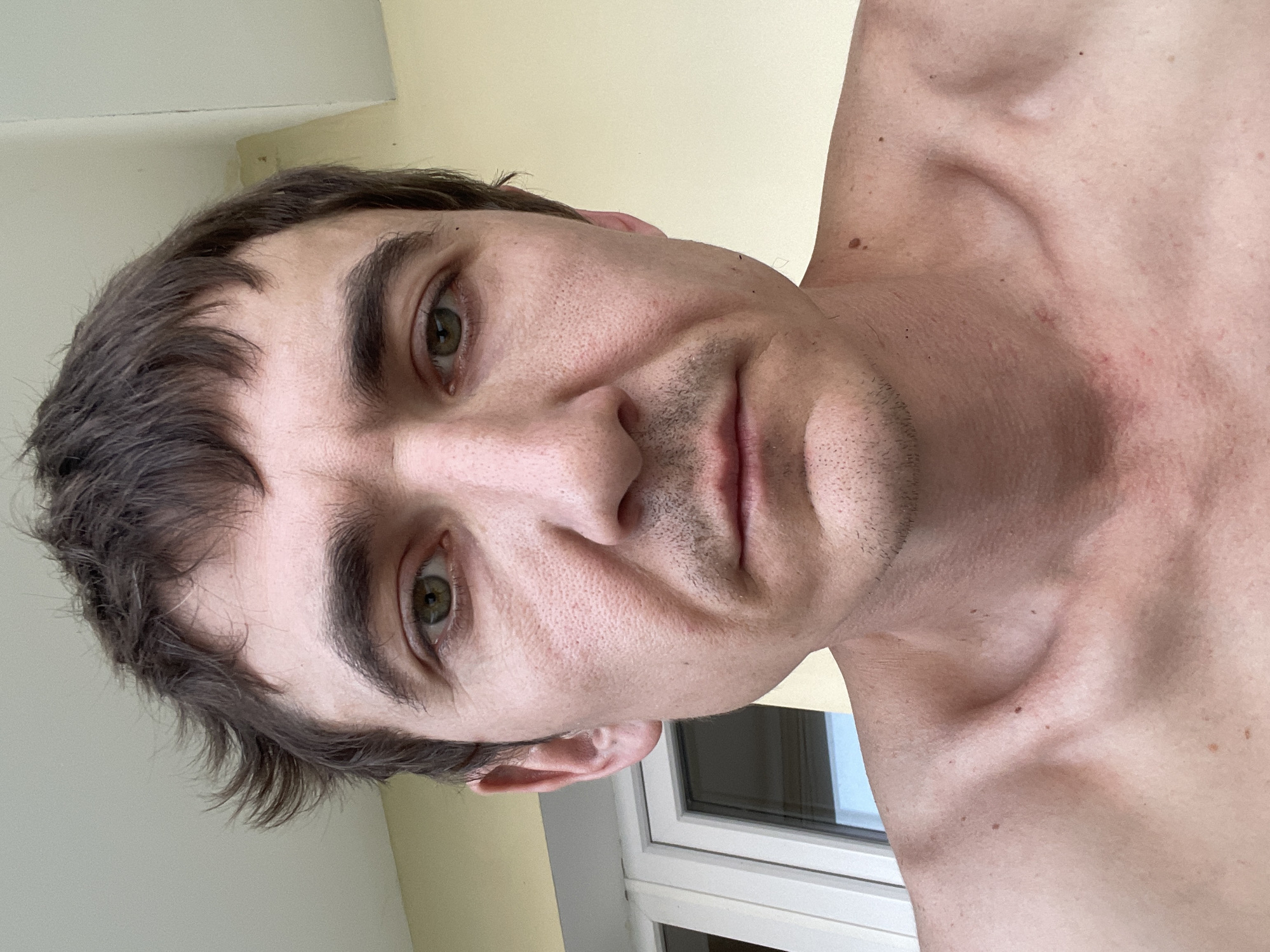 A close-up, chest-up selfie of a fair-skinned man with light brown hair and green eyes is shown. He is looking directly at the camera with a neutral expression. His skin appears flushed, particularly on his neck and chest, and there are several small moles visible on his upper chest and collarbone area. He is shirtless, and his shoulders and collarbones are prominent. In the background, a white-framed window with a light blue sky visible through it can be seen to the left, and a plain yellow wall occupies the rest of the background. There is a light fixture visible at the top of the frame. The image is well-lit, suggesting it was taken outdoors during the daytime, possibly on a balcony or patio. The man appears to be of average build. No specific landmarks in Laishevo, Russia are identifiable in this image, as the background is generic.