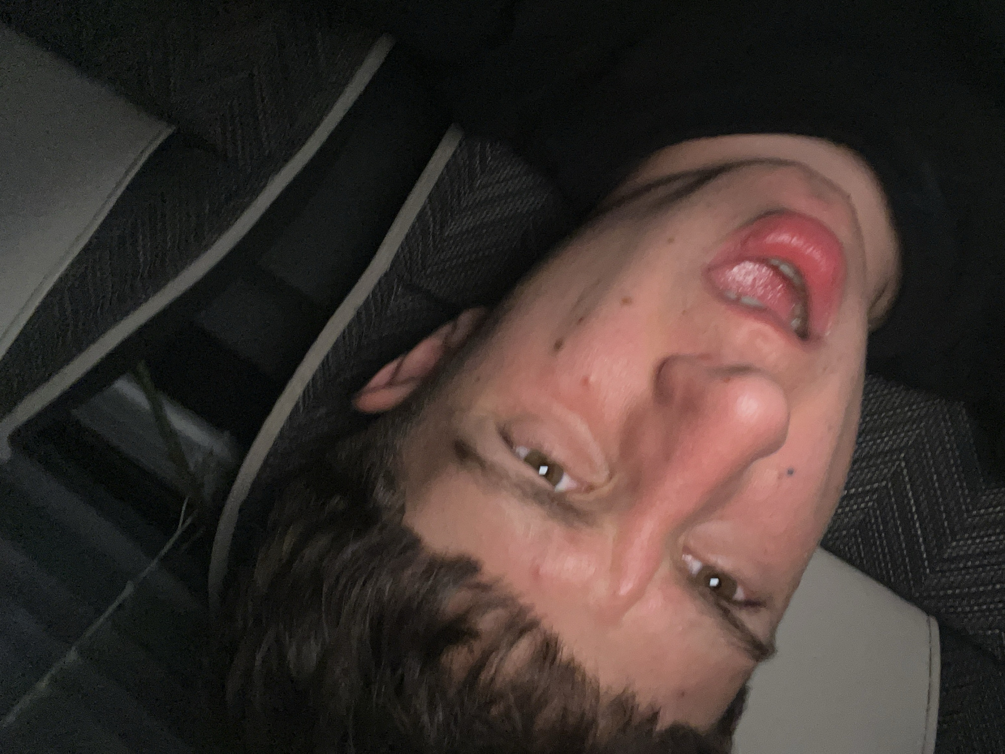 An individual with brown hair is positioned upside down in what appears to be a vehicle. The person's mouth is partially open, revealing their tongue. The interior of the vehicle features dark upholstery with lighter-colored stripes. The location is unknown.