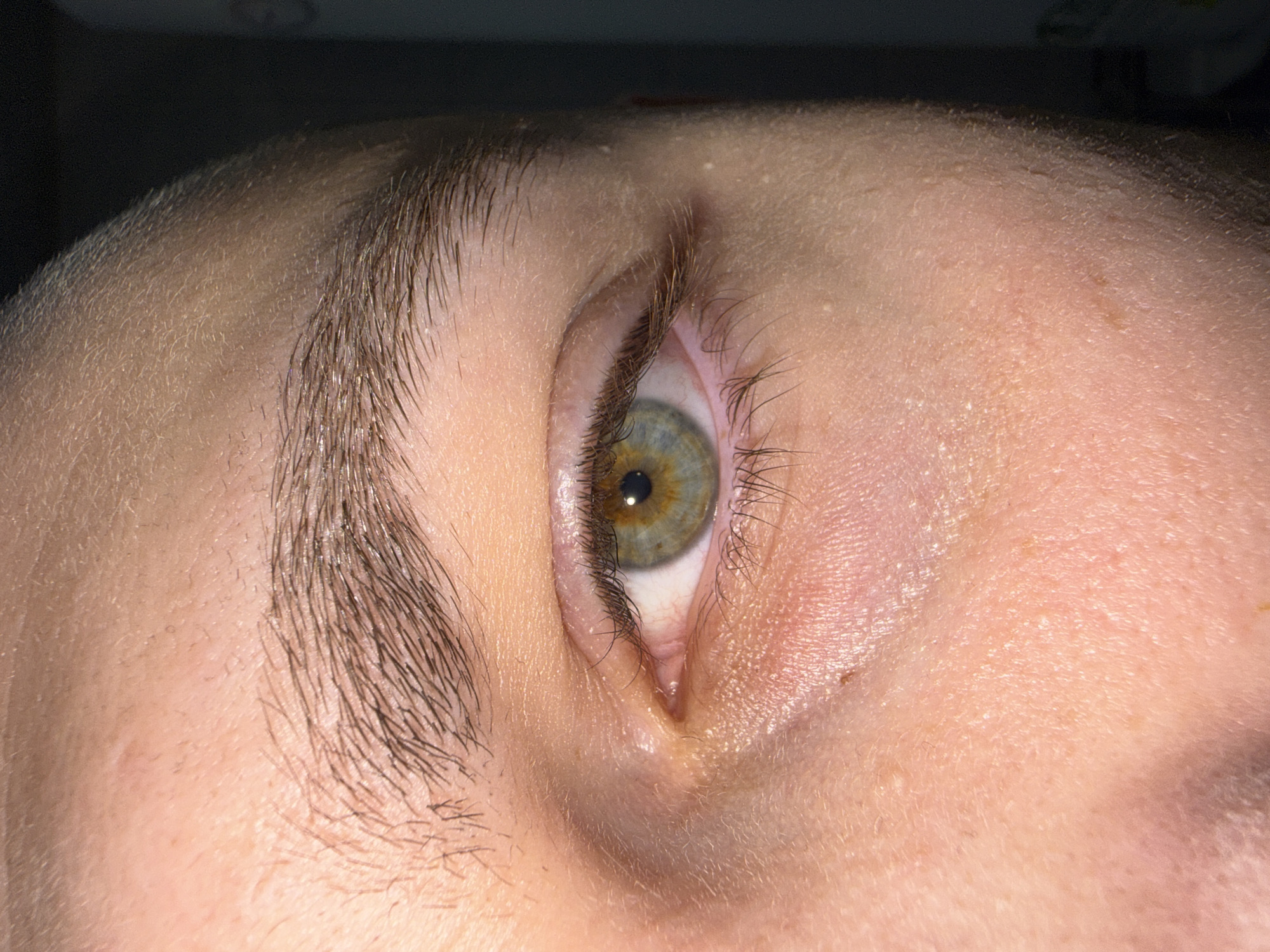 A close-up, angled view of a person's right eye. The iris is multi-colored, displaying a mix of green, blue, and brown hues, with a dark pupil at the center. The eyebrow is brown and lightly groomed. The skin around the eye appears light-toned with small bumps and possibly some subtle redness. The image does not provide any information about the location or city of Stara Zagora, Bulgaria.