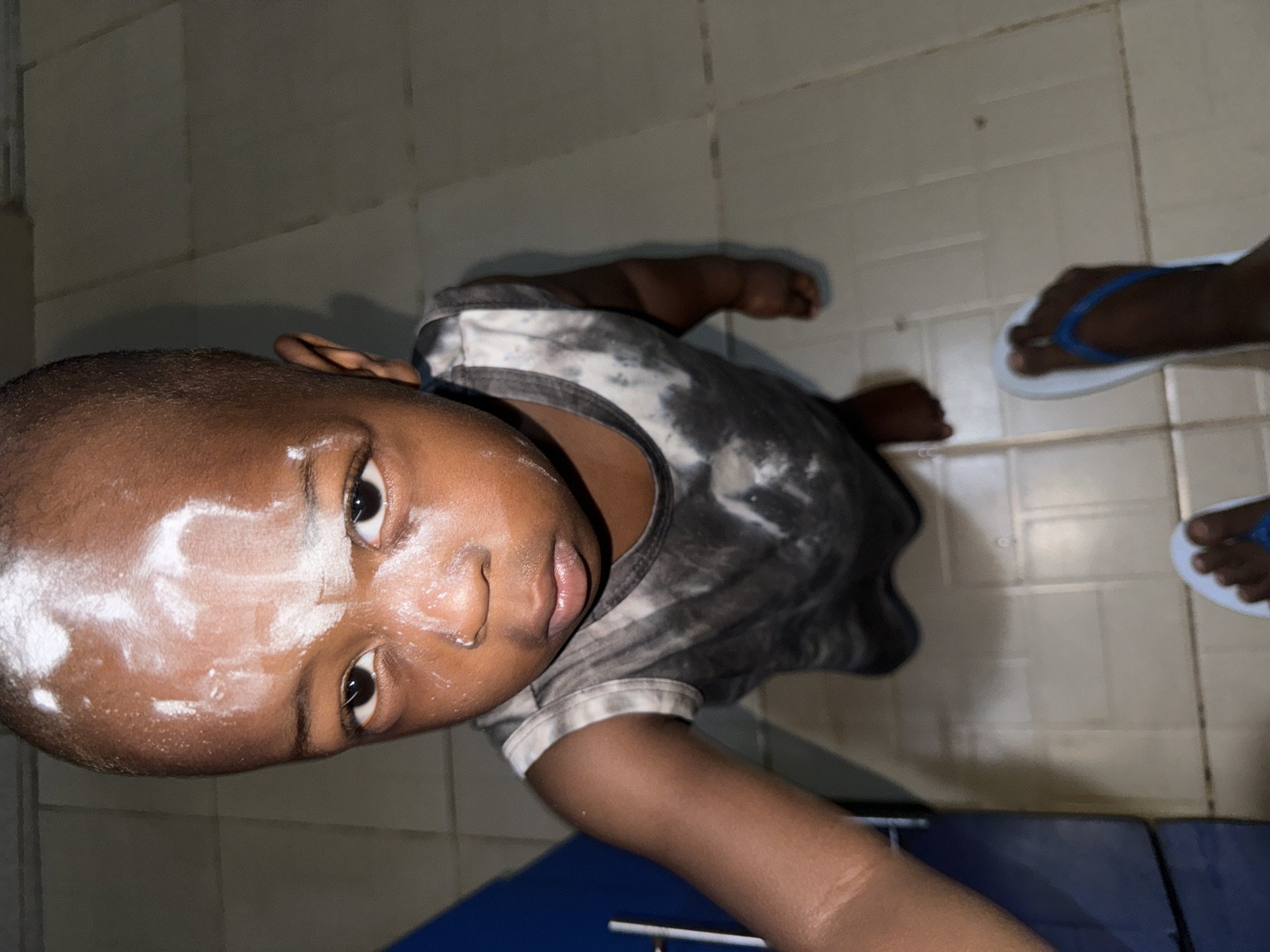 A child is looking directly at the camera. There's a smattering of white powder on their forehead, reaching towards their nose. The child wears a gray tie-dye shirt. The setting appears to be an indoor tiled space, likely a bathroom. An adult's feet in flip-flops are partially visible in the upper right of the frame. The image was taken in Sabon Tasha, Nigeria.