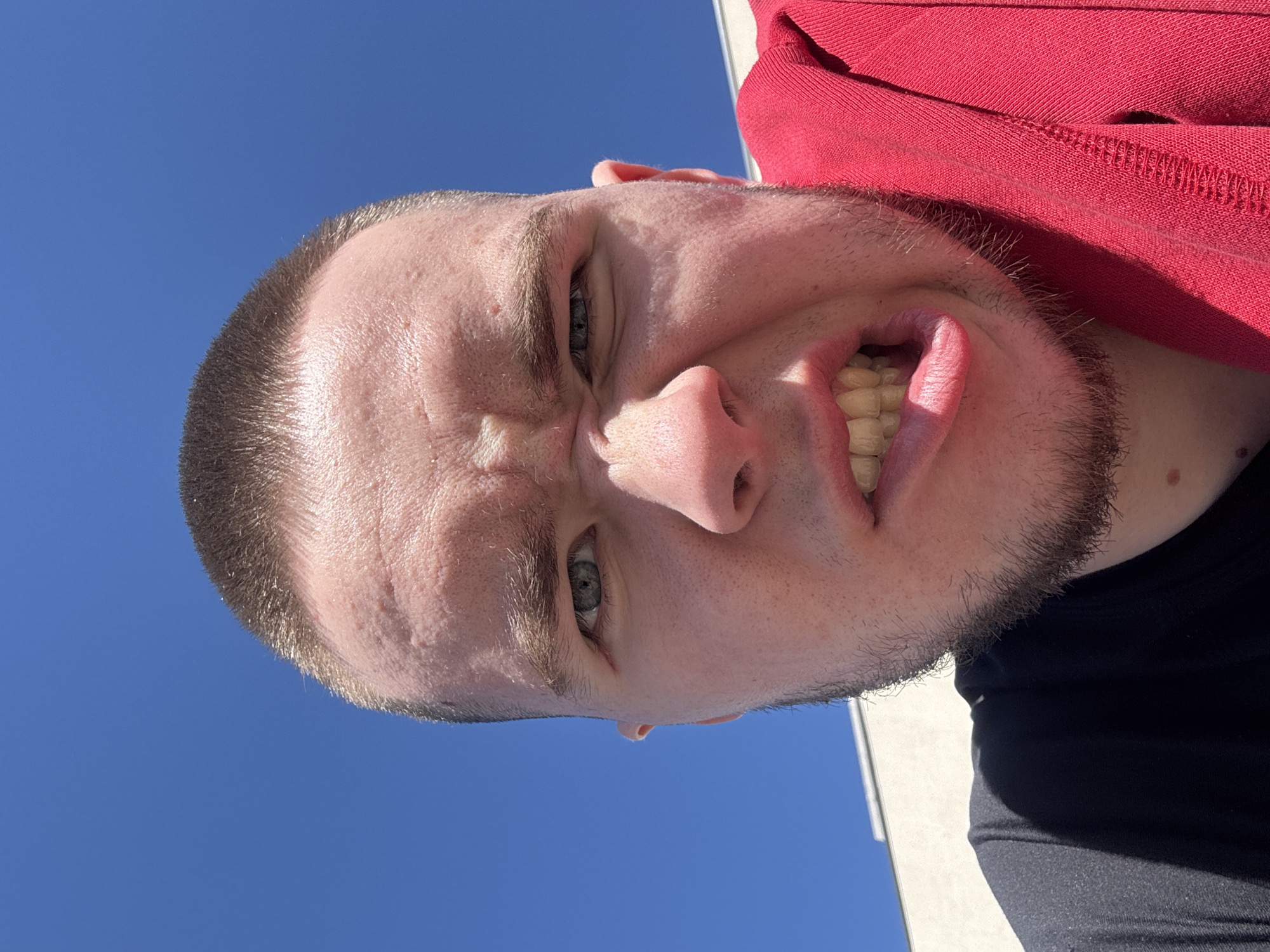 A close-up, low-angle shot shows a man's face against a bright blue sky. The man has a shaved head with short brown hair, fair skin with some acne scarring on his forehead, and a light brown beard. He is wearing a red hooded sweatshirt and a black shirt. The man is pulling a grimace, with his eyebrows furrowed and his mouth open, revealing his teeth. The background features a clear blue sky and a white building. There is no discernible information in the image to indicate the location is Kazan, Russia.