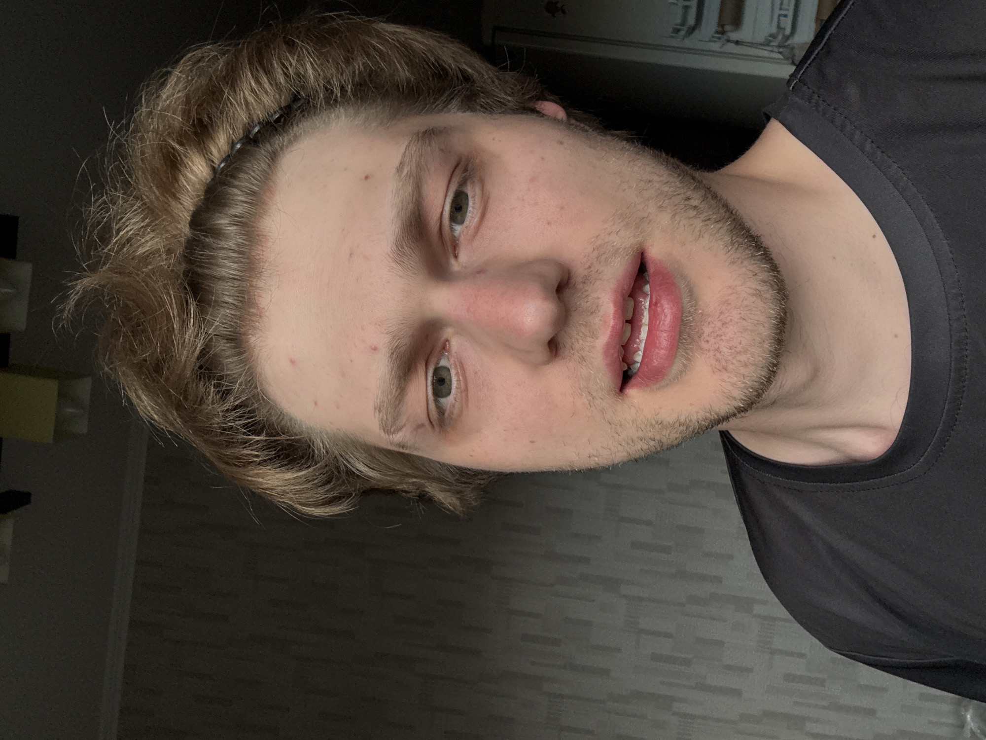 A young Caucasian male with light brown hair, a dark t-shirt, and stubble is shown in a close-up selfie. He has light green eyes and appears to have some redness around his nose and eyes, as well as a few blemishes on his forehead and cheek. His mouth is slightly open, revealing his teeth. He is wearing a black headband. The background is a dimly lit room with a patterned wallpaper and a slightly out-of-focus wardrobe to the right. The image was taken indoors in Khimki, Russia.