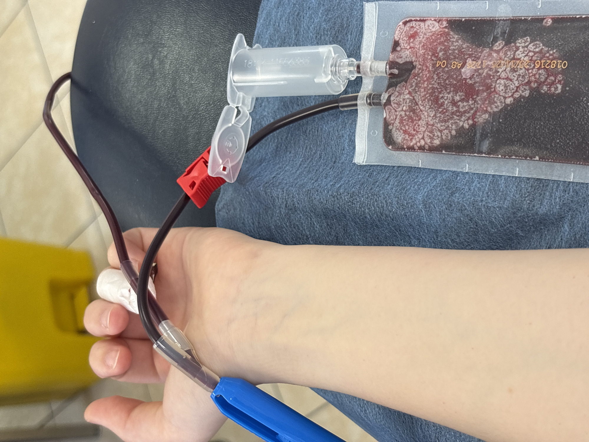 This close-up image depicts a blood donation or phlebotomy procedure occurring in a medical facility, likely in Saint Petersburg, Russia. The main subject is a fair-skinned person's left forearm and hand, connected to a blood collection system.
Dark red blood is being drawn from the person's arm into a transparent plastic bag via a series of tubes and connectors. The tubing is secured to the arm with white medical tape. A clear plastic Y-connector and a red clamp are visible along the tubing path. The rectangular blood collection bag, partially filled with blood, displays noticeable patterns of separation or clotting within the fluid. Visible text on the bag, appearing somewhat reversed, includes "018216," the date "23/11/2021," the time "17:25," and "AB 04," likely indicating batch information, collection details, and blood type. Another clear plastic component with the partial inscription "18:..." is attached to the tubing near the bag.
The person's arm rests on a dark blue fabric, possibly jeans or a medical drape. In the background, a portion of a bright yellow object, likely a medical waste bin, is visible to the left. The upper left corner shows a dark, textured surface, potentially part of a chair or table, and a light-colored tiled floor, reinforcing the indoor, clinical setting. The image focuses entirely on the medical equipment and the process of blood collection; no faces are visible, and therefore, no emotions can be discerned. The time of day and weather conditions are not ascertainable from the photograph.