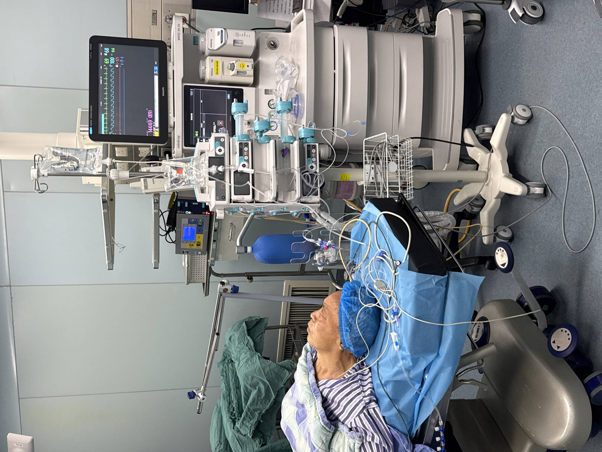 The image depicts an elderly patient lying on a surgical table in what appears to be an operating room or intensive care unit. The patient is covered in a blue surgical drape, wearing a blue surgical cap, and is connected to various medical monitoring devices, including wires and tubes. Medical equipment, including monitors displaying vital signs and a complex anesthesia machine, surrounds the patient. The brand "Mindray" is visible on some of the devices. A hospital bed or chair is visible in the foreground. The environment suggests a modern medical facility. Although Yuzhong District, China, is specified, no elements in the image provide specific geographic clues to confirm this location.
