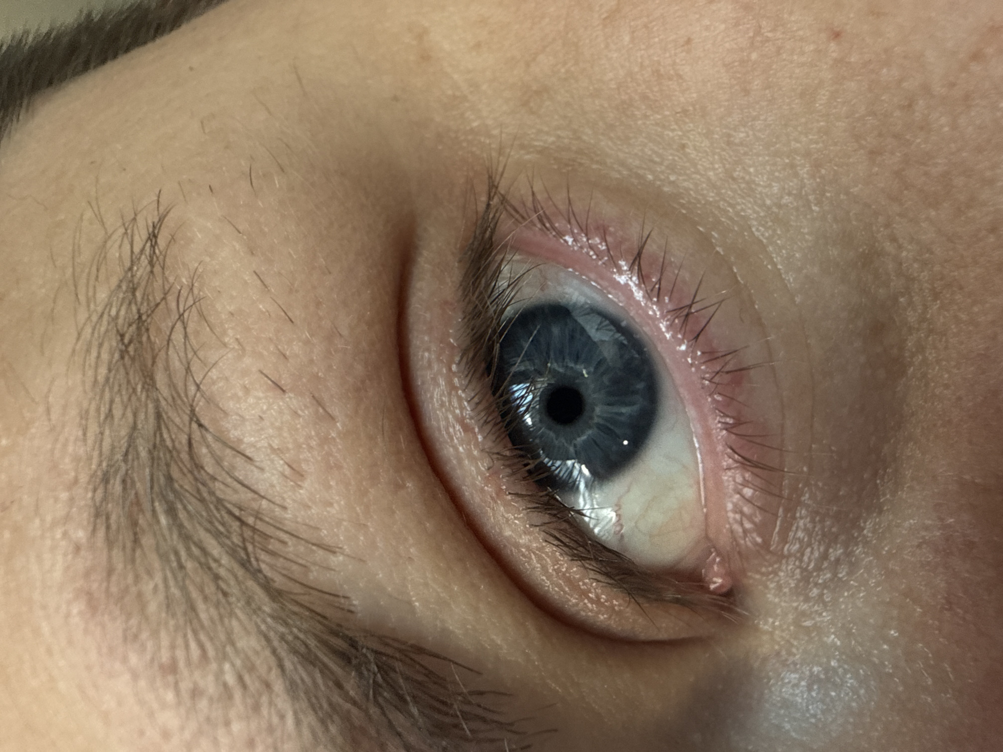 The image is a close-up, macro photograph of a human eye. The iris is blue with a dark pupil. The sclera is visible and appears healthy. Eyelashes frame the eye, and the surrounding skin shows texture and pores. There are also some fine hairs above the eyelid, possibly from an eyebrow. No specific location in Vladivostok, Russia can be determined from this image.