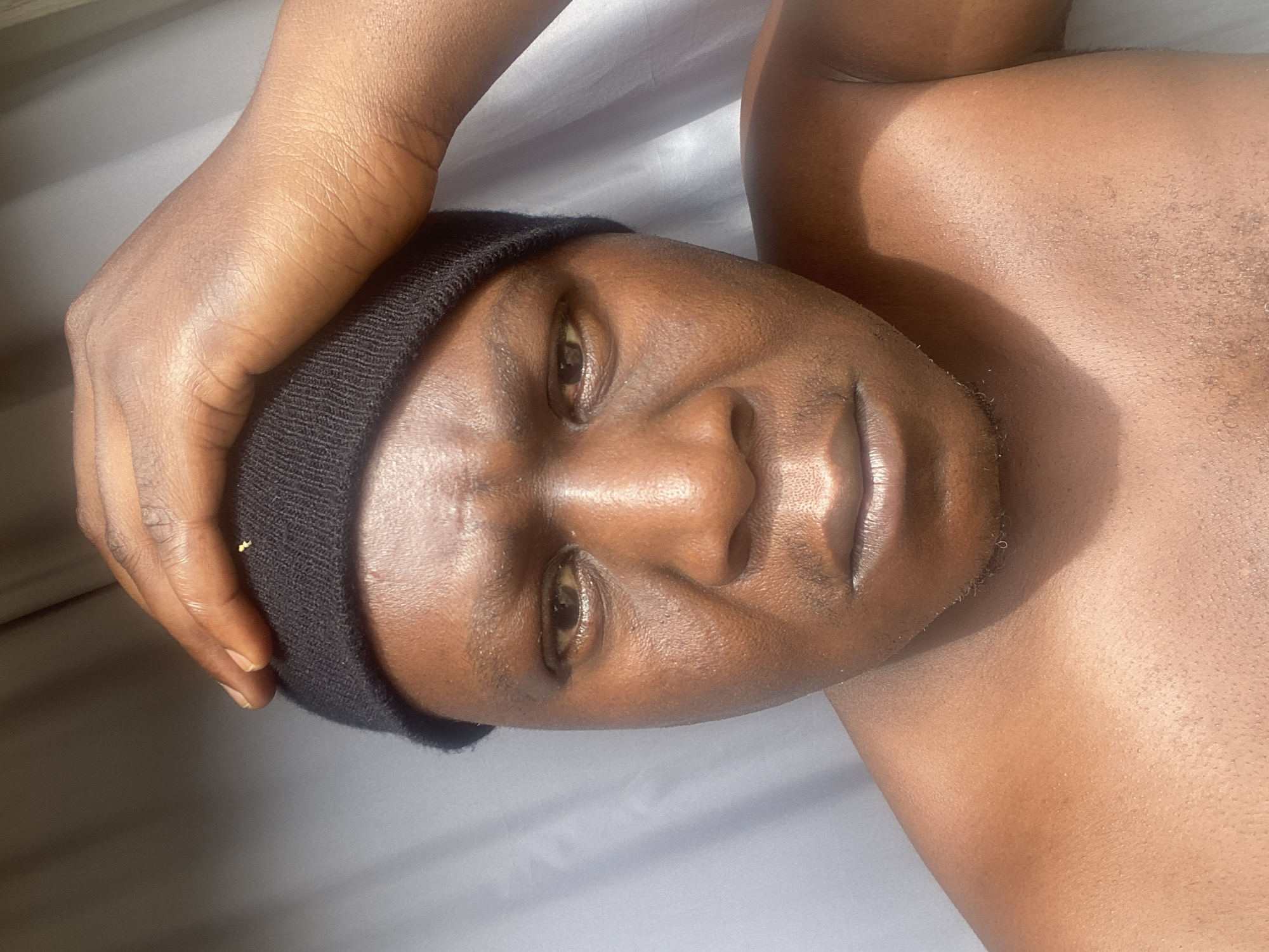 In Sabon Tasha, Nigeria, a close-up, head-and-shoulders portrait captures a person wearing a black beanie. Their right hand is placed on top of their head, fingers spread. The individual appears to be looking directly at the camera with a neutral expression. The background consists of a light-colored, draped fabric. The lighting suggests a bright, possibly outdoor, environment casting subtle shadows. The skin tone is dark brown, and there are visible pores and some light perspiration on the forehead and cheeks. The image is taken from a slightly low angle, looking up at the subject.