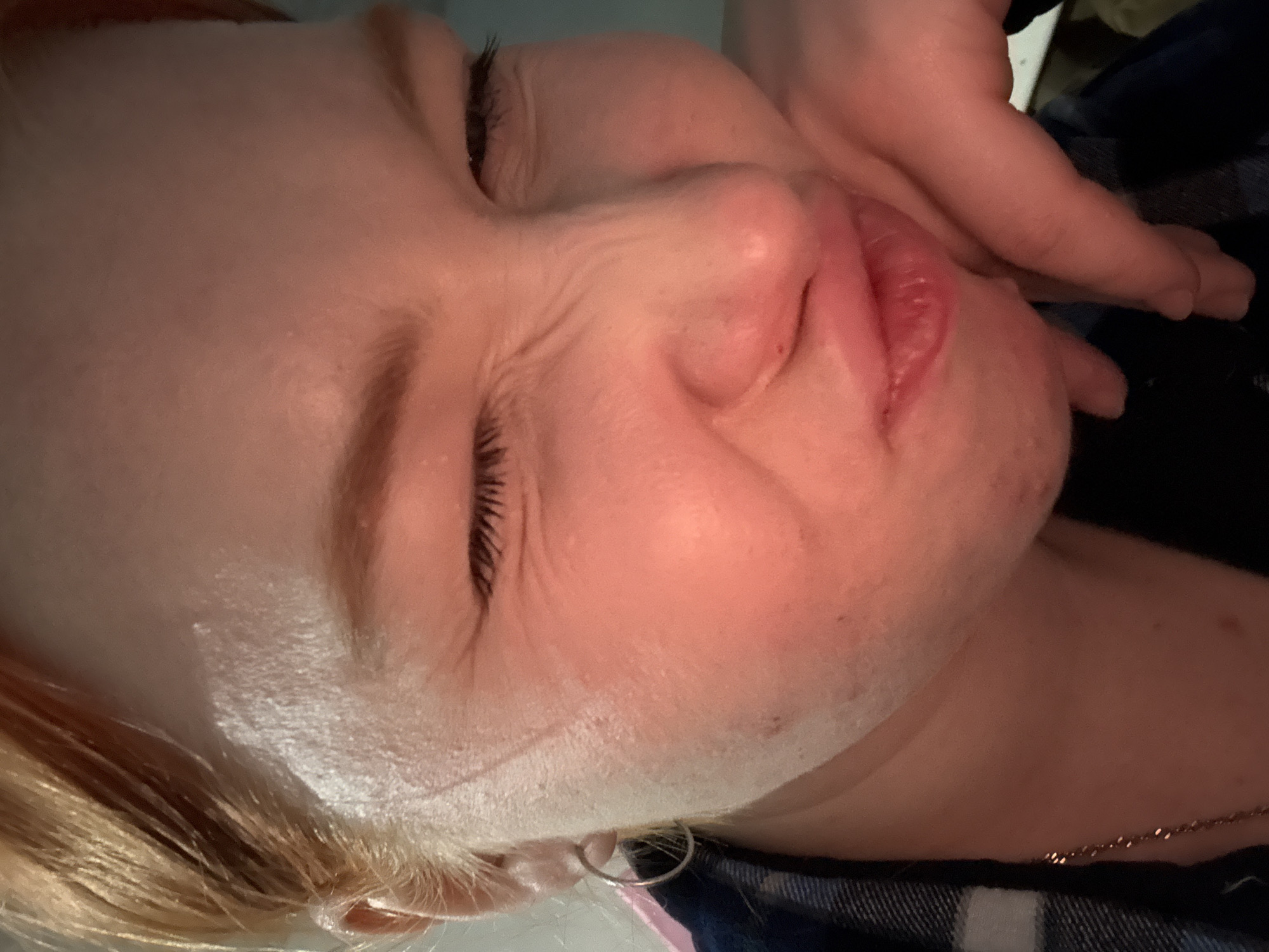 A close-up, angled shot captures the face of a person, likely a woman with blonde hair, seen from above and slightly to the side. Her eyes are closed or squinting tightly, and her mouth is slightly open, forming a grimace that suggests pain, discomfort, or an intense emotional experience. Deep wrinkles are visible around her left eye and nose, consistent with the strained expression. Her lips appear full, possibly chapped or slightly swollen.
A hand, with fingers gently curled, is visible on the right side of her face, near her mouth and jawline, though its action (comforting, supporting, or otherwise) is not clear. The person's skin is fair, with some areas appearing slightly red around the nose and mouth. Blonde hair frames the left side of her face, and a small, silver-colored hoop earring is visible in her left earlobe. A delicate, fine chain necklace is draped around her neck and visible on her chest.
The background shows a blue and white checkered fabric, possibly part of clothing or bedding. The lighting is soft and warm, suggesting an indoor setting, possibly dim. No text is visible in the image.