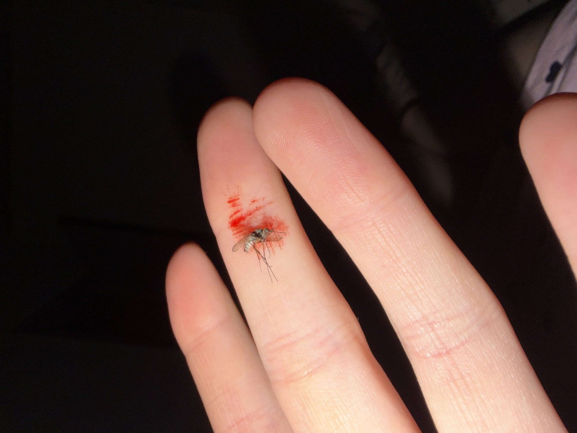 The image depicts a person's fingers. On the tip of the middle finger, a dead mosquito is laying in a pool of blood. The background is dark and out of focus. There is no information in the image about the city of Chaikovsky, Russia.