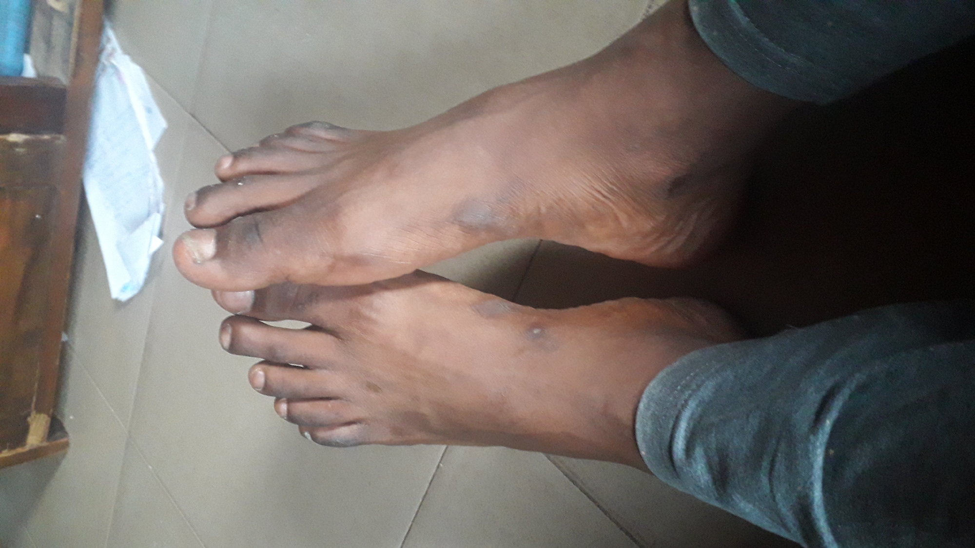 The image shows a close-up view of a person's feet, with visible toenails and skin texture. The feet are resting on a tiled floor. In the background, a wooden object and some papers are visible. The scene appears to be indoors, possibly in a residential or office setting in Nkpor, Nigeria. The lighting suggests it might be daytime.