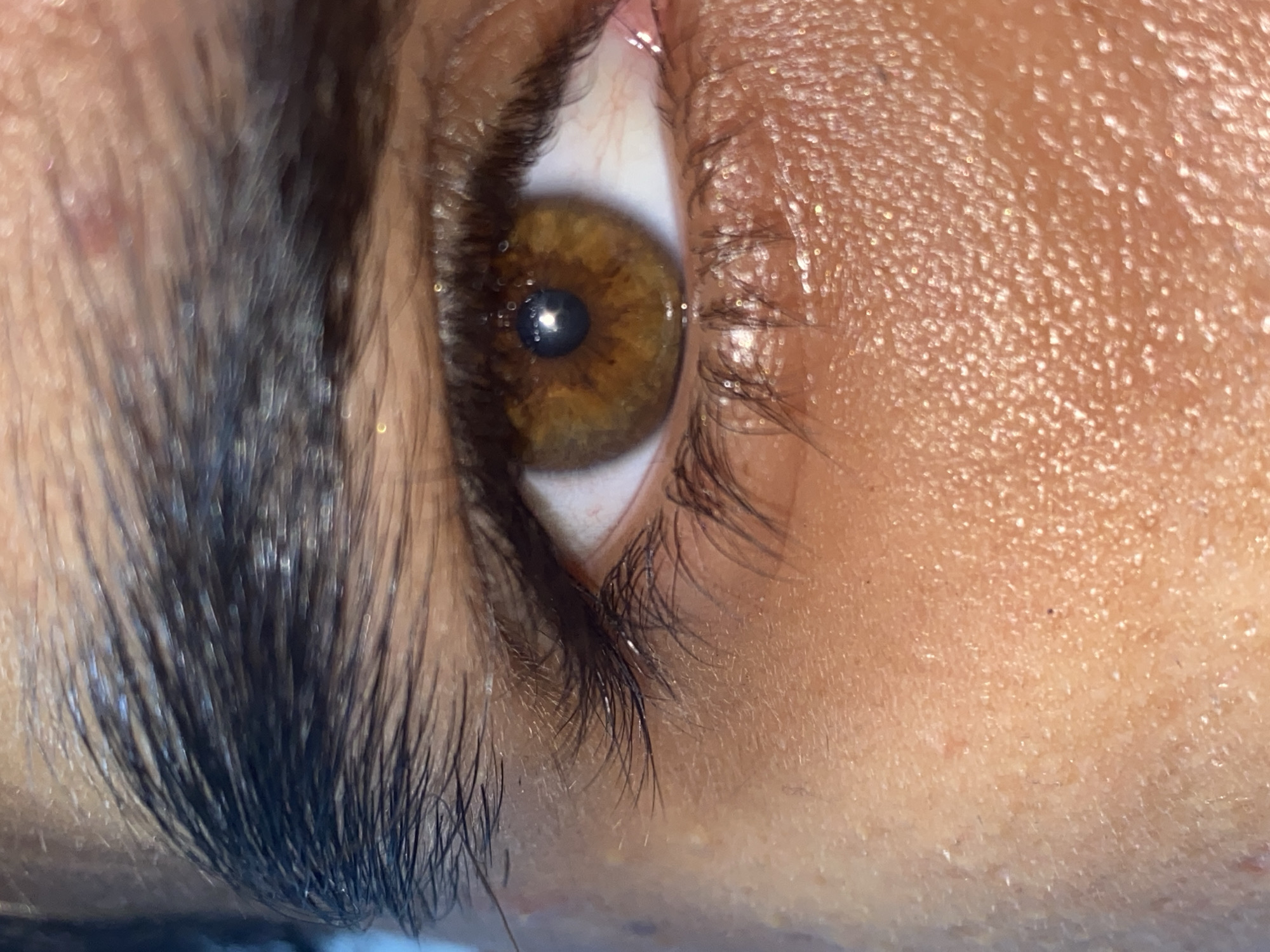 The image shows a close-up of a brown human eye with long, dark eyelashes. The skin around the eye is light brown and appears slightly oily. There is no indication of location, city or country in this image. There is no forensic information contained within this image.