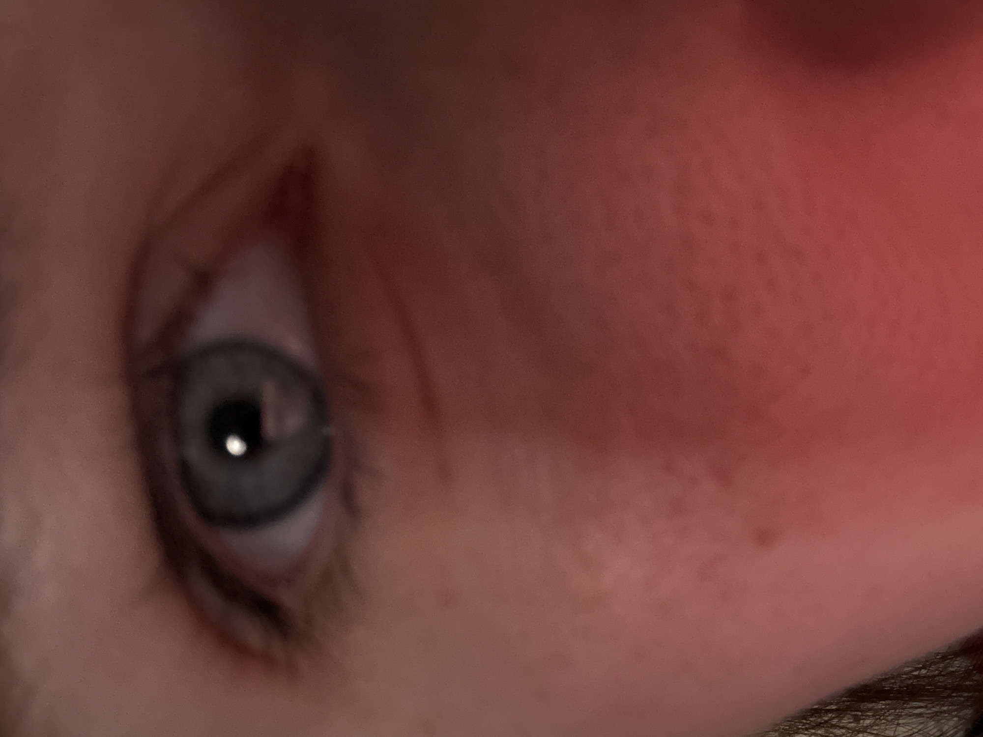 A close-up, blurry image shows a human eye with blue irises and surrounding facial skin, which appears red and possibly irritated. The location (Unknown, Russia) is not discernible from the image.