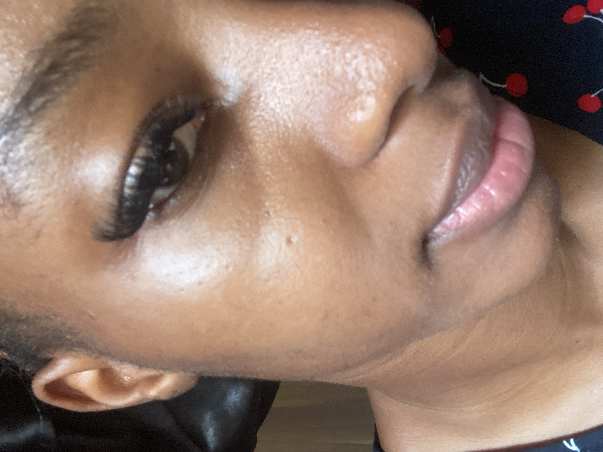 A close-up, angled portrait depicts the right side of a person's face with dark brown skin, located in the city of Jos, Nigeria. The right eye, with a dark iris and prominent dark eyelashes, is directed upwards. A dark eyebrow is visible above the eye. The bridge and side of the nose are present, along with the right cheek, which exhibits visible pores and minor skin texture variations, including subtle elevated blemishes. The lower lip and a portion of the upper lip, displaying a natural pinkish-brown hue, are visible in the lower right quadrant, indicating a soft expression. The right ear is partially visible on the left side of the frame. Dark, tightly textured hair is observed near the ear and forehead. A dark, possibly satin, fabric is visible behind the subject's head, and a garment featuring a black background with red cherry patterns is present in the lower right corner of the image. The illumination is soft and diffused.