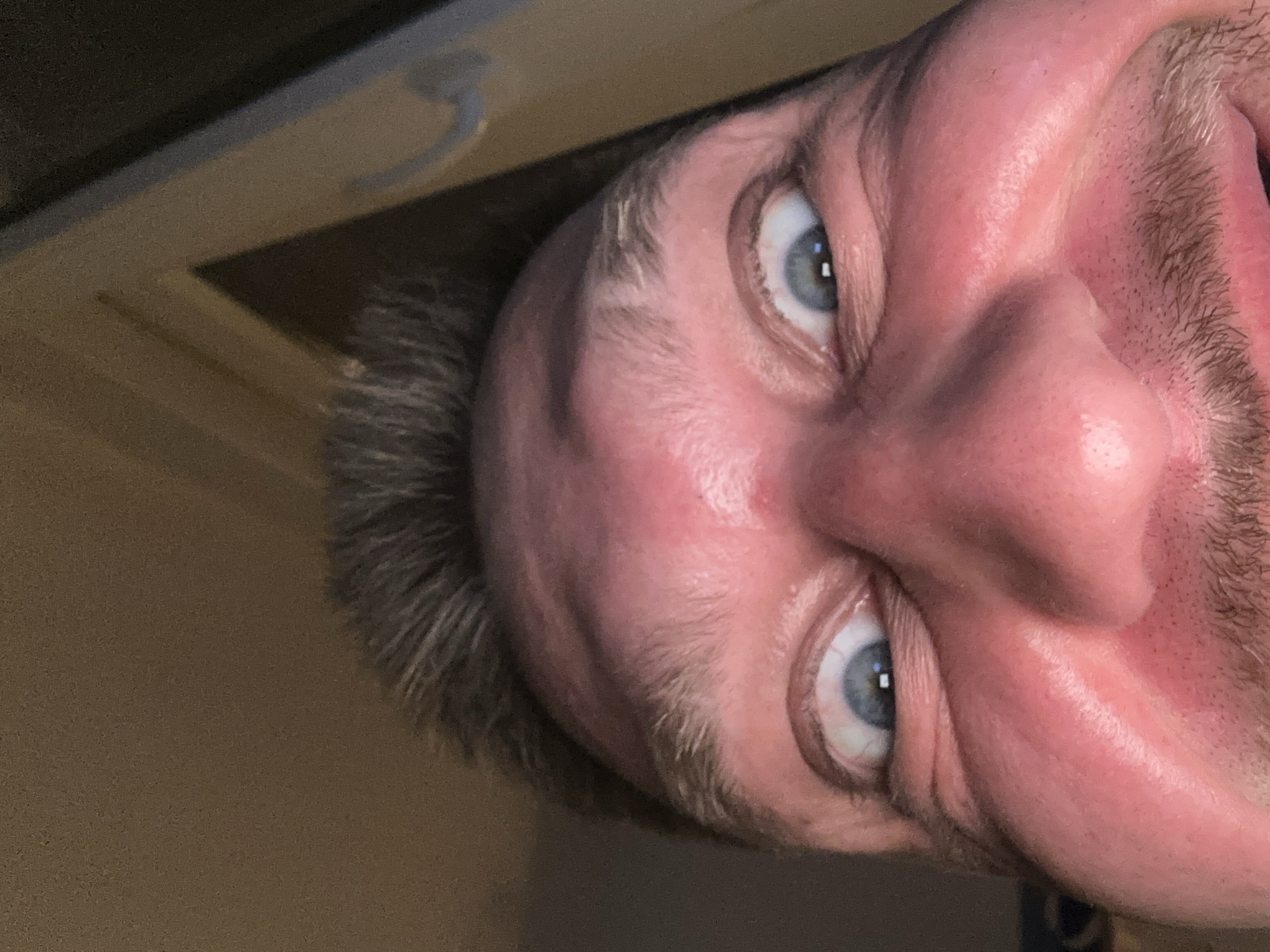 The image is a close-up, low-angle shot of a person's face, focusing on their eyes, nose, and forehead. The individual has fair skin, light blue eyes, and short, dark-brown hair with some graying. Their eyebrows are light brown and somewhat sparse. The person's expression appears surprised or wide-eyed, with the pupils slightly dilated. Their cheeks are flushed. The background is out of focus and appears to be an indoor environment with a textured, brown wall on the left and a lighter-colored surface with a curved line on the right, possibly a doorway or furniture. No specific details of Zvezdara Urban Municipality, Serbia are visible.