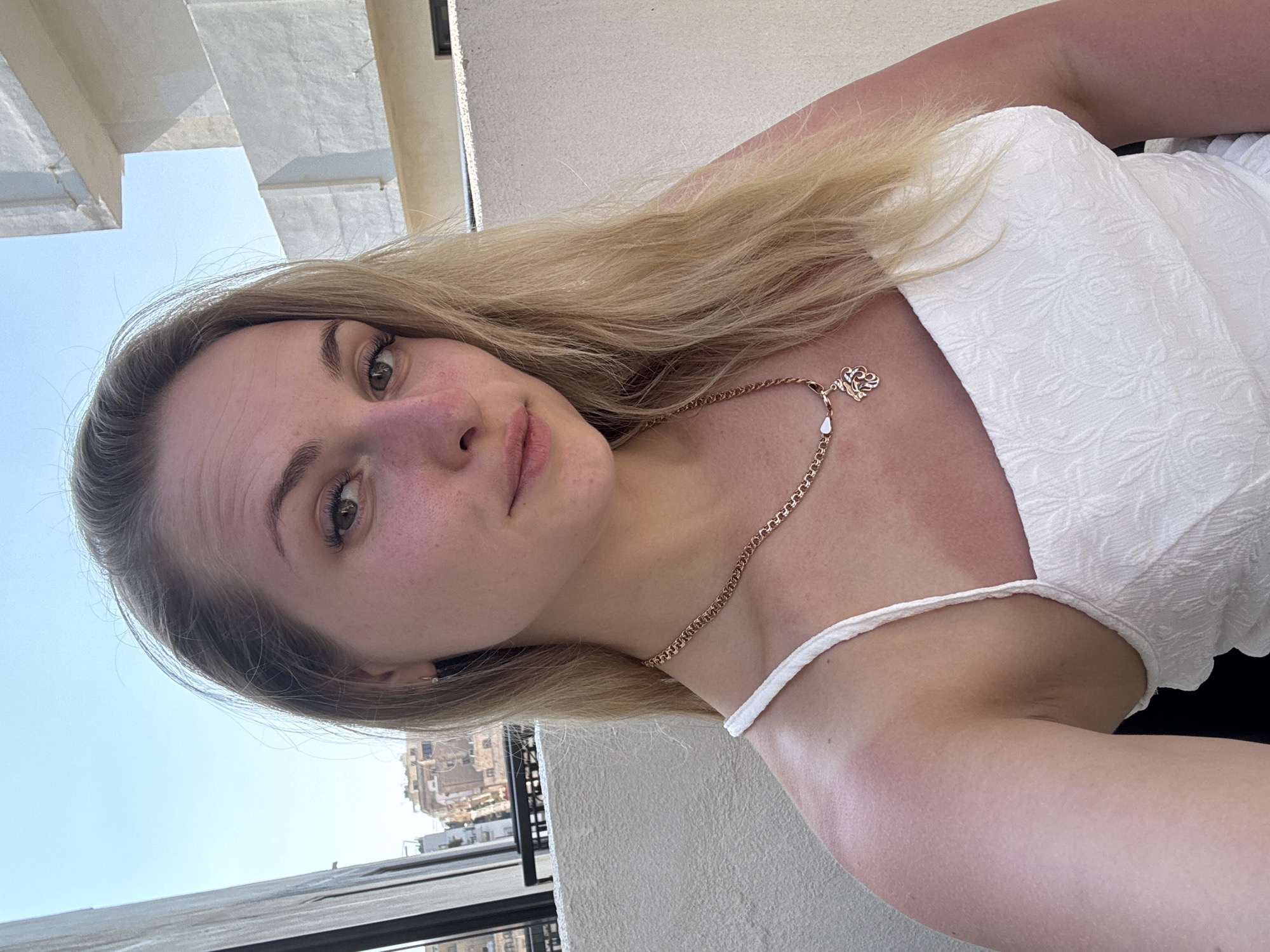 A young Caucasian woman with blonde hair and green eyes is pictured in an outdoor urban setting. She is wearing a white sundress and a gold necklace. Her skin shows signs of sunburn on her shoulders and upper arms. The background features buildings and a clear blue sky. The image is a close-up, self-taken photograph.