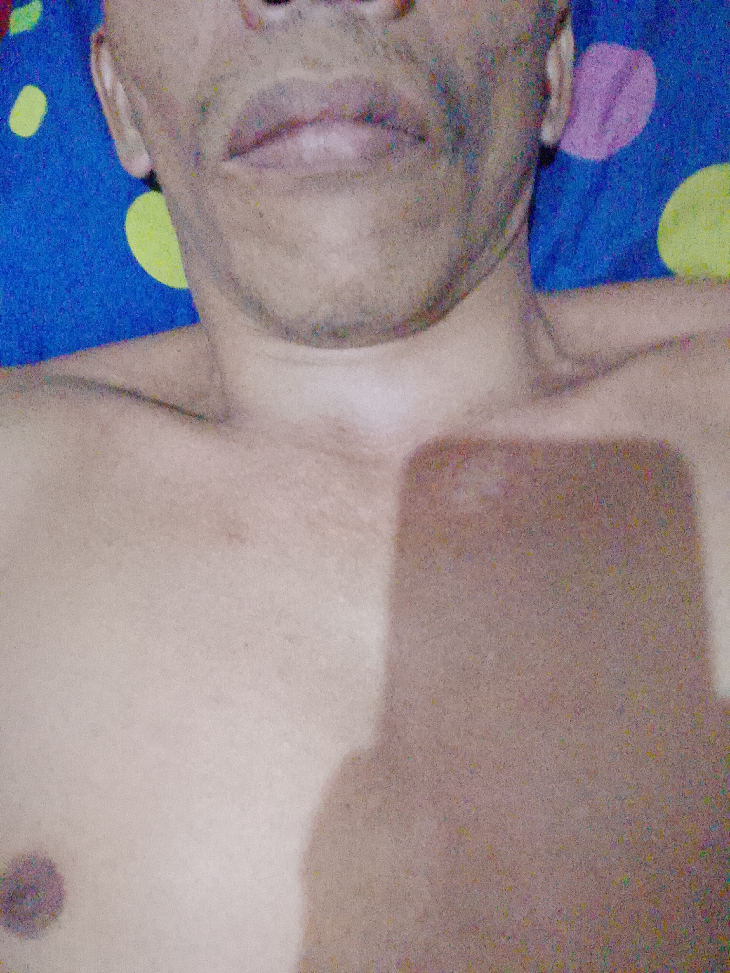 A close-up image of a shirtless man from the upper chest up to the mouth, seemingly lying on a blue bedspread with large yellow and purple polka dots. The bottom half of the image is the man's chest. A dark rectangular shadow is cast across the chest, obscuring the view. The man's head is centrally framed with his lips closed. His skin tone appears tan. The environment consists of the colorful polka-dotted bedspread. There are no visible buildings or other landmarks to suggest the location of Bukit Ketok, Indonesia.