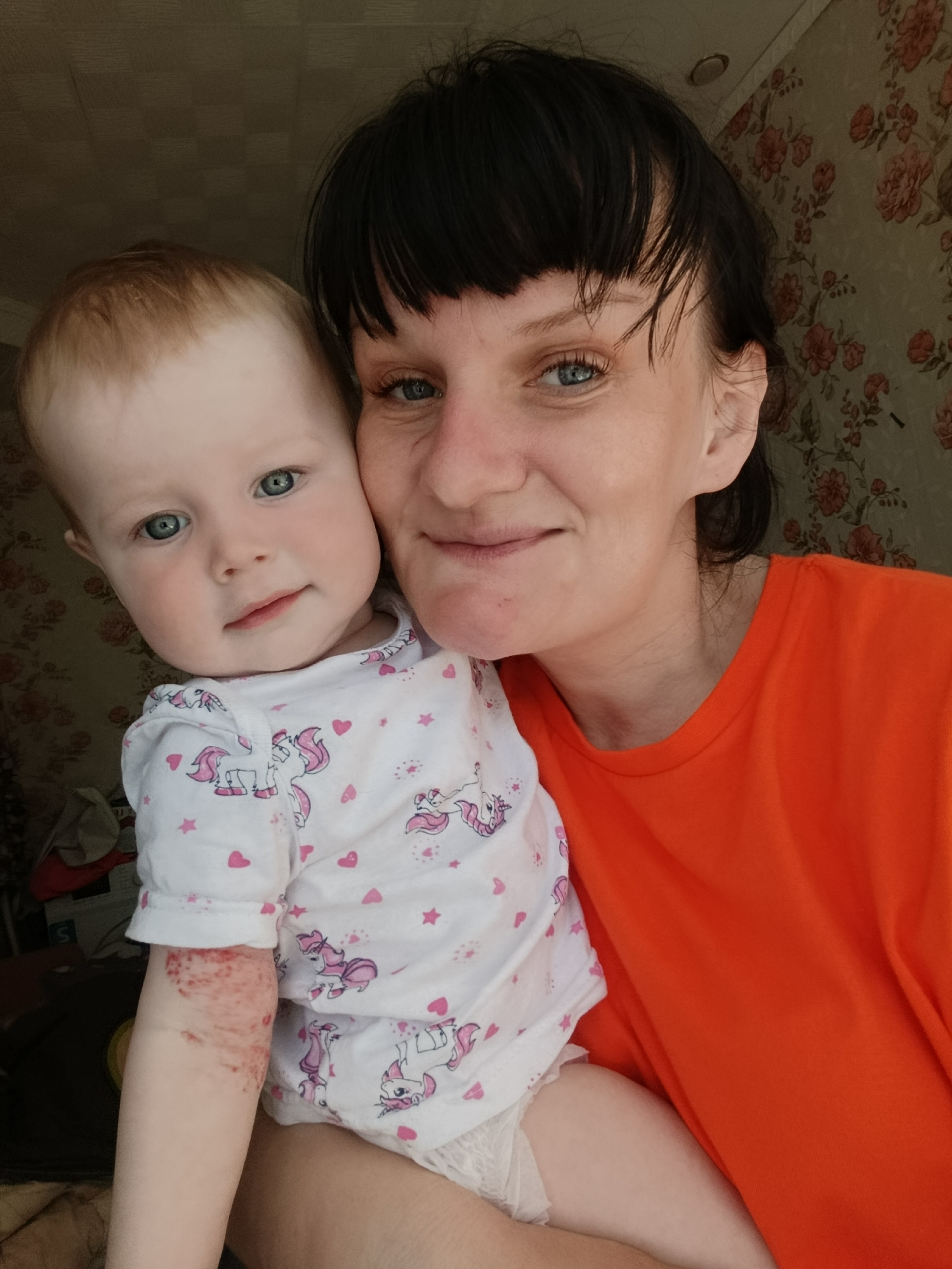 A medium shot depicts a woman holding a baby. The woman has dark hair, light skin, and is wearing an orange shirt. The baby has red hair, light skin, and is wearing a white shirt with pink unicorns and stars. The baby has a rash on their left arm. The background is a wall with floral wallpaper. The location is potentially Фоки, Russia.