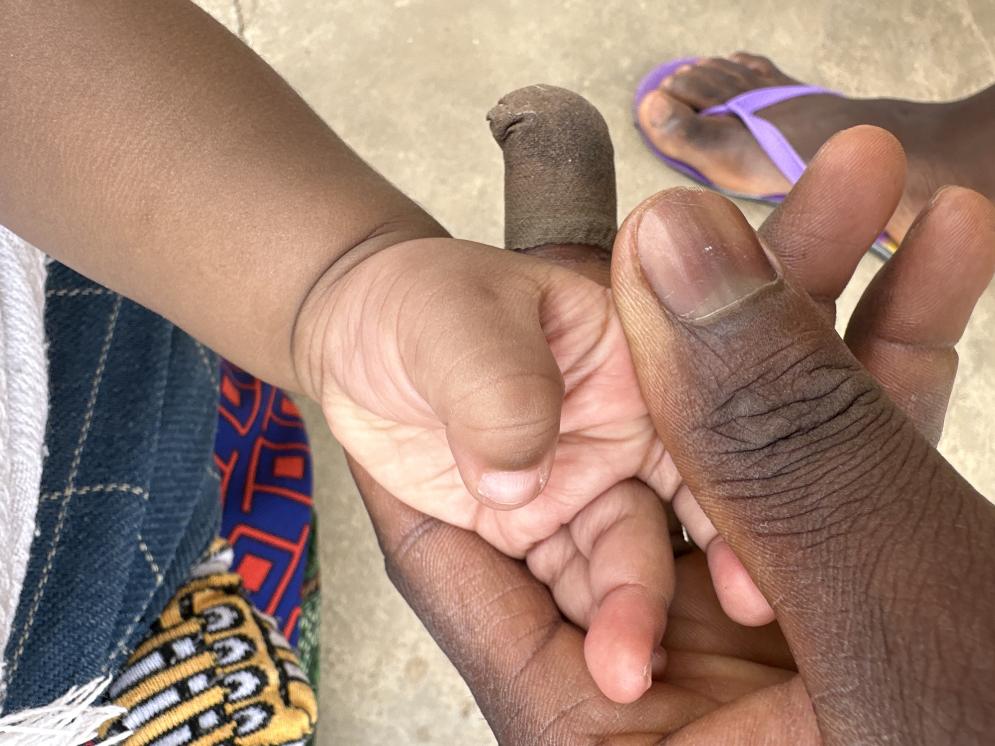 This close-up image captures a tender moment between an adult and a young child, set in what appears to be an outdoor, well-lit environment in Jos, Nigeria.
The primary subjects are the hands and arms of an adult and a baby or young child. The adult, with dark skin, holds the child's small, lighter-skinned hand. The child's left hand is gently clasped around the adult's index finger. This adult's index finger is distinctly wrapped or bandaged with a dark, textured material. In the background, part of the adult's left foot is visible, wearing a vibrant purple flip-flop on a light-colored, possibly concrete, ground surface.
The child's arm is partly visible, adorned with various fabrics: a white textured cloth, a blue denim-like material with white stitching, and a colorful patterned fabric featuring yellow, black, red, and blue geometric designs, suggestive of an African print.
The activity depicted is an intimate interaction, highlighting connection and care between the adult and child. The natural lighting suggests it is daytime. No specific weather conditions are discernible, but the outdoor setting implies clear conditions. The dark skin tones, the type of footwear, and the patterned clothing are consistent with the provided location context of Jos, Nigeria. The overall mood conveyed is one of warmth, protection, and affection. There is no visible text in the image.