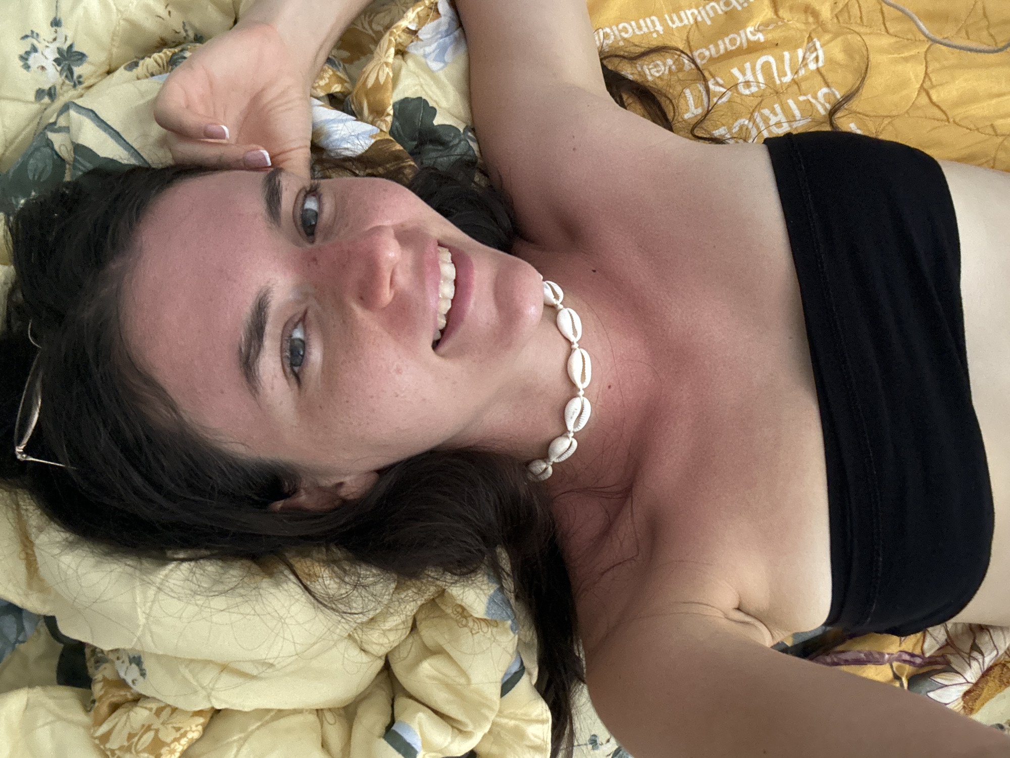 A medium shot shows a woman lying on a bed in Mũi Né, Vietnam. She is wearing a black strapless top and a necklace made of white seashells. Her long dark hair is spread out on the pillow. Her fair skin appears sunburned on her upper chest and face, but she is smiling at the camera. The bed has a yellow and blue floral pattern on the bedding, and writing is faintly visible on the pillow. Glasses sit on the bed next to her face.