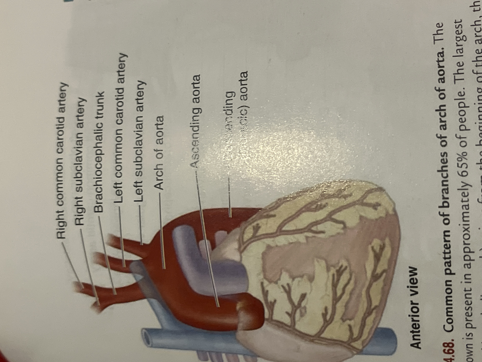 The image is a diagram of the anterior view of the human heart, with labels pointing to major arteries branching from the aorta. These arteries include the right common carotid artery, right subclavian artery, brachiocephalic trunk, left common carotid artery, left subclavian artery, and the arch of aorta. The ascending aorta and descending (thoracic) aorta are also labeled. The diagram is accompanied by a caption numbered 4.68, describing the common pattern of branches of the arch of aorta. The image does not contain any information about the city of Jalingo, Nigeria, or any people, actions, or interactions.