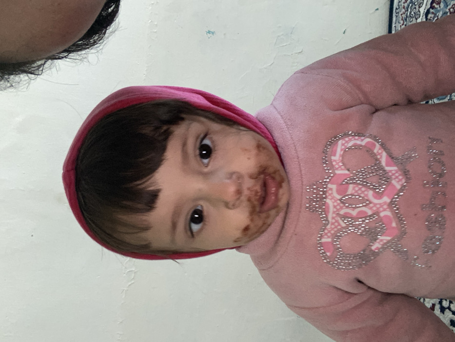 A young child is depicted in an indoor setting in Kandahar, Afghanistan. The child has dark hair with bangs and is wearing a pink hooded top featuring a silver and pink crown design. A dark brown substance, consistent with food residue, is smeared around the child's mouth, nose, and cheeks. The child's eyes are open, looking directly at the camera. In the upper right corner, a portion of an adult's head, showing dark hair and skin, is visible. The background is a plain, light-colored, textured wall with minor blue marks. A patterned rug, displaying dark blue, red, and white elements, is partially visible in the lower left, beneath the child.