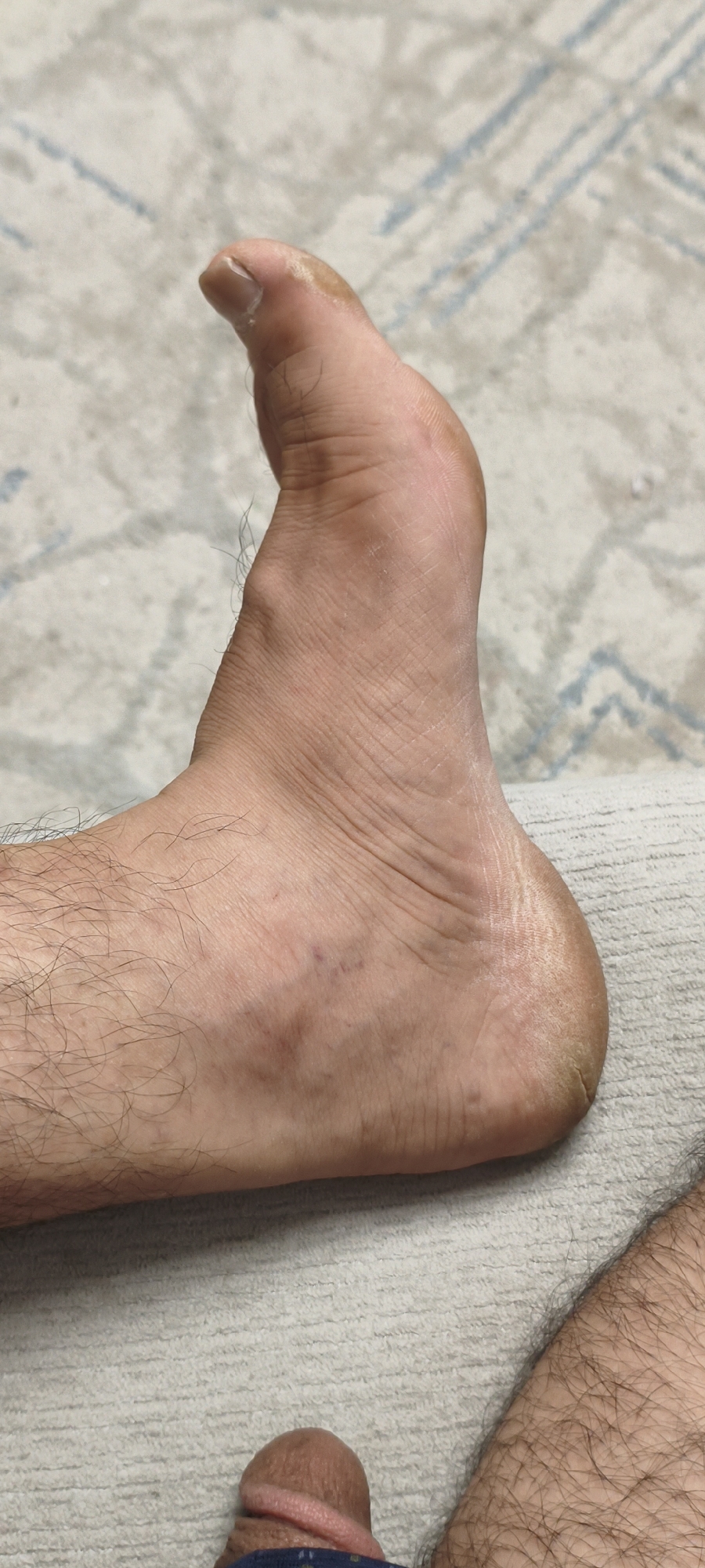 The image is a close-up, eye-level shot of a person's left foot, with the toes pointing upwards and the heel resting on a textured, light-colored surface, possibly a rug or upholstered furniture. The foot is tanned and shows visible skin texture, including fine lines and some sparse hair on the ankle area. The big toe is particularly prominent, bent upwards at an unusual angle. The heel also appears dry and slightly cracked. Partially visible in the lower portion of the frame, and out of focus, is a portion of male genitalia, suggesting the image was taken by the person themselves or in a private setting. The background consists of a patterned rug with faint blue lines. There is no discernible indication of location within Tashkent, Uzbekistan.