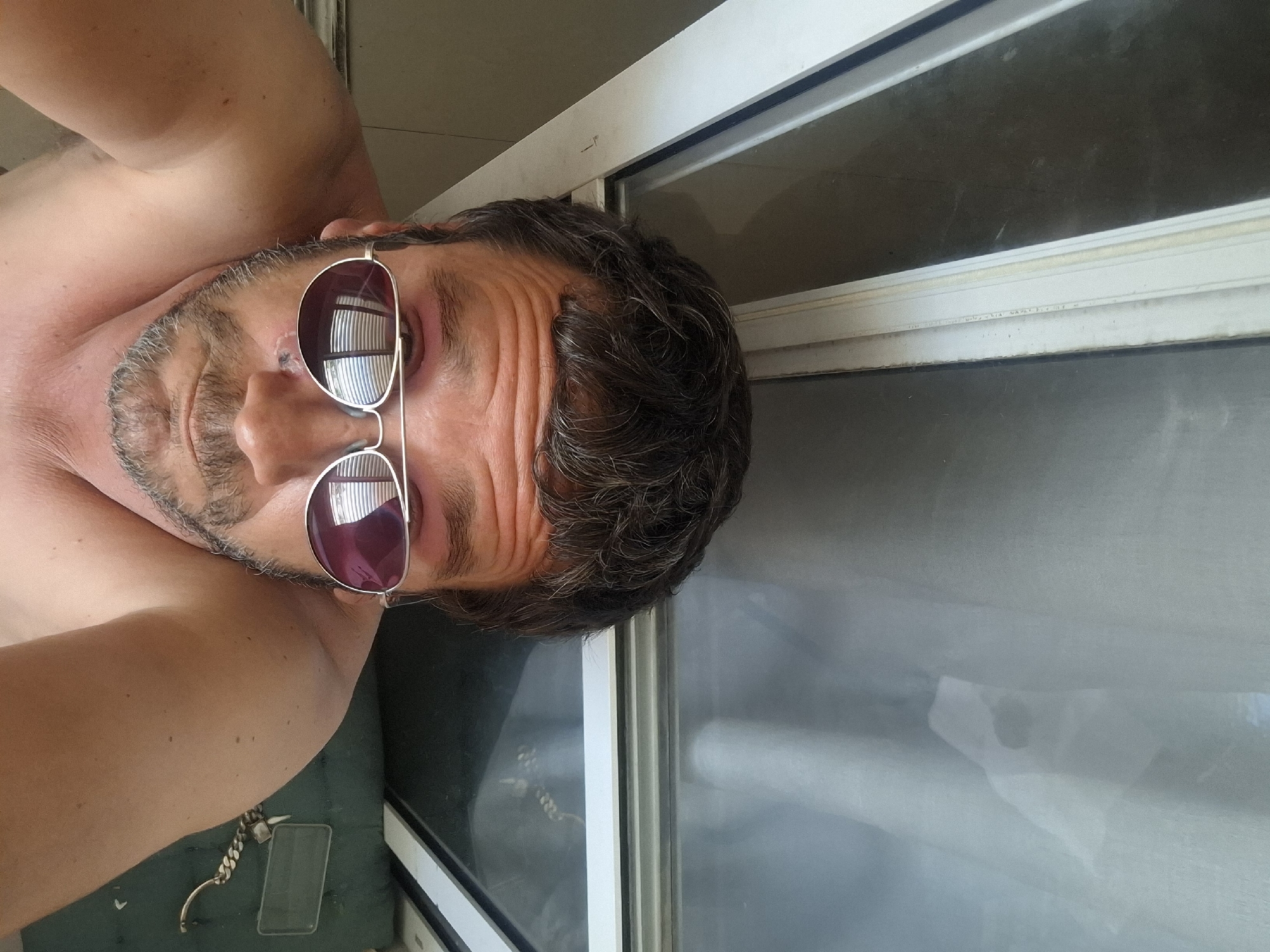 A man with dark, messy hair, stubble, and sunglasses is pictured from a low angle, looking upwards. His left eye area appears bruised, and there is a visible cut or abrasion on his cheek. He is shirtless, and his shoulder is visible. In the background, there are vertical blinds visible through a window, and a green surface with a chain and a clear case. The setting appears to be indoors, possibly in Yerocham, Israel, given the lighting and window structure.