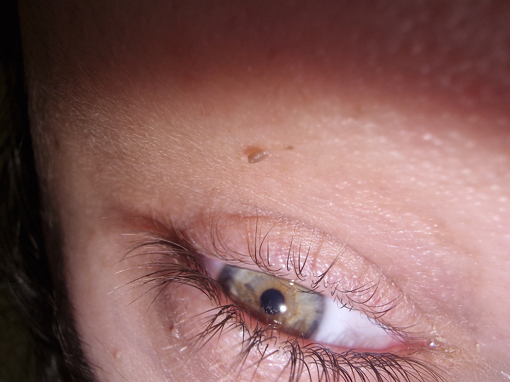 This media file features an extreme close-up of a human eye and the surrounding facial skin. The eye has a hazel or greenish-brown iris with a dark, round pupil. Long, dark eyelashes frame both the upper and lower eyelids.
A notable detail is a small, raised, light brown lesion or mole located on the skin above the upper eyelid, closer to the eyebrow area. It appears to have a slightly irregular and bumpy texture. The skin generally appears smooth with fine vellus hair visible, particularly on the upper eyelid and surrounding areas. Moisture or tear film is apparent along the lower eyelid margin and on the surface of the eyeball.
The lighting is direct, creating highlights on the eye's surface and the skin. The focus is very tight, highlighting the intricate details of the skin texture, individual eyelashes, and the unique pattern of the iris. There is no specific activity depicted, and no visible text. The location and time of day cannot be determined from the image.